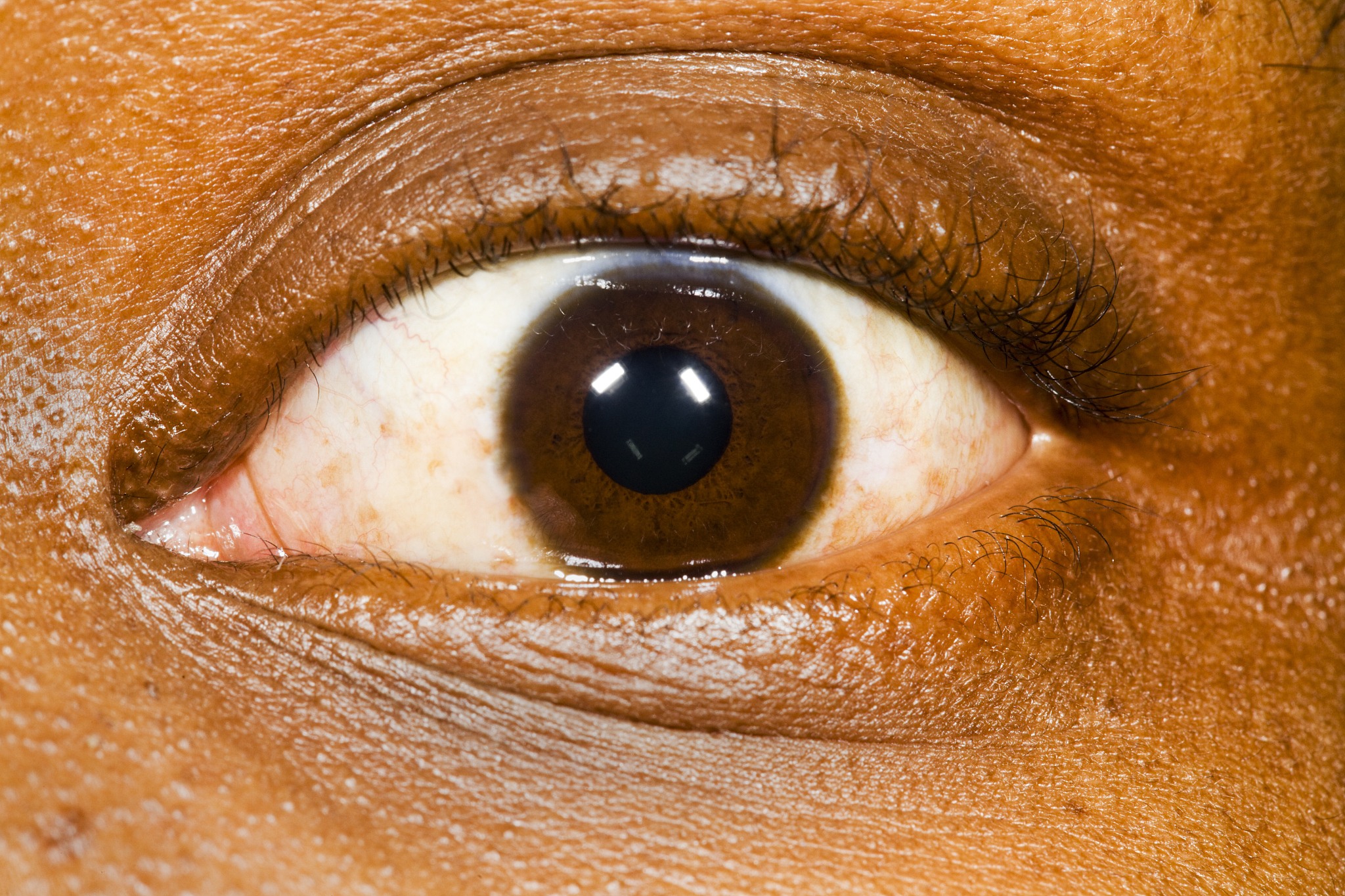 brown eye