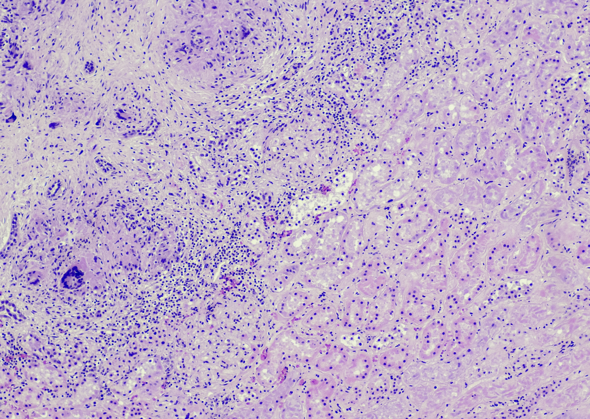 Isolation of Primary Human Endometrial Epithelial and Stromal Cells Through a Modified Protocol