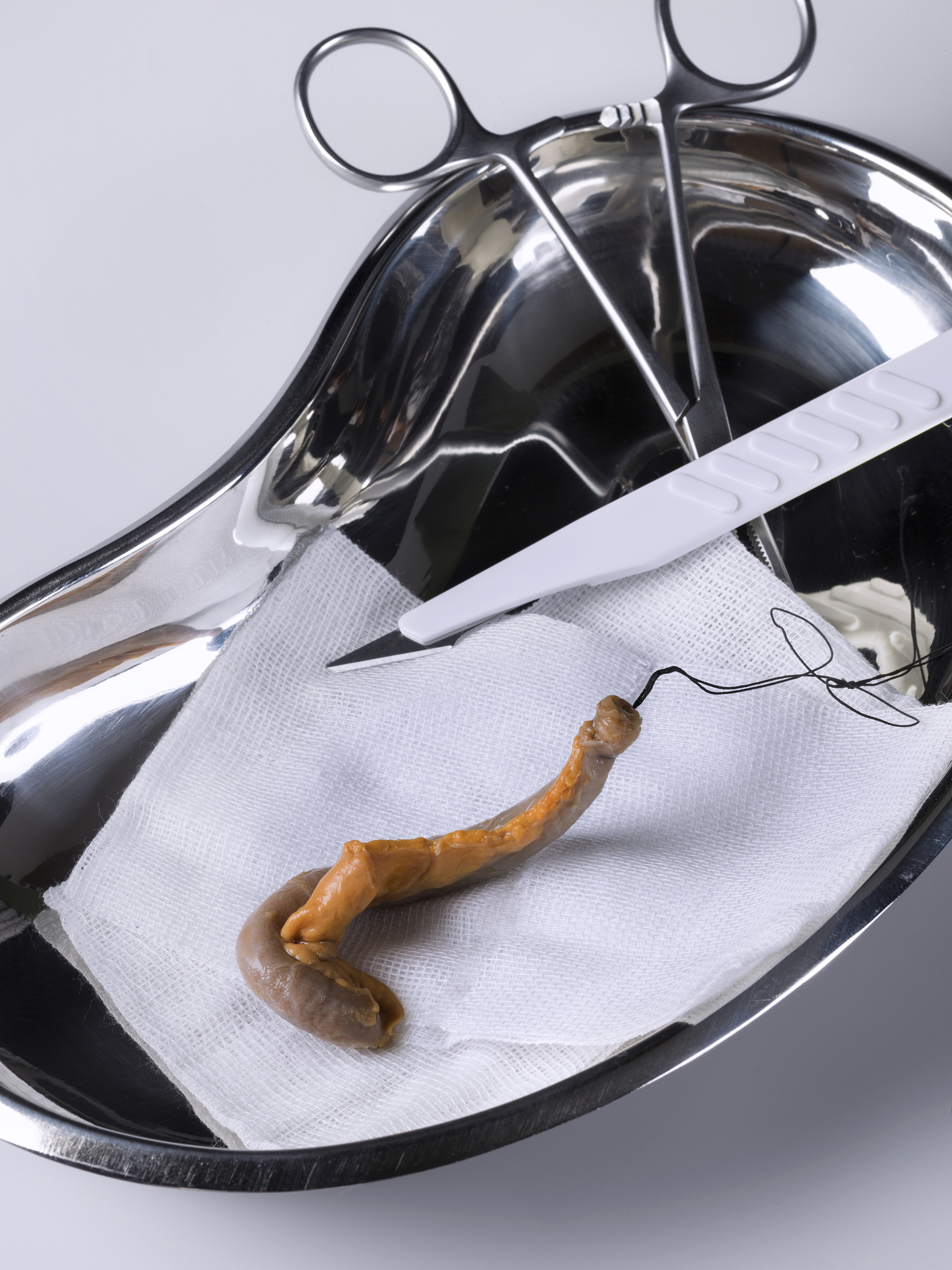 天津阑尾炎微创医院