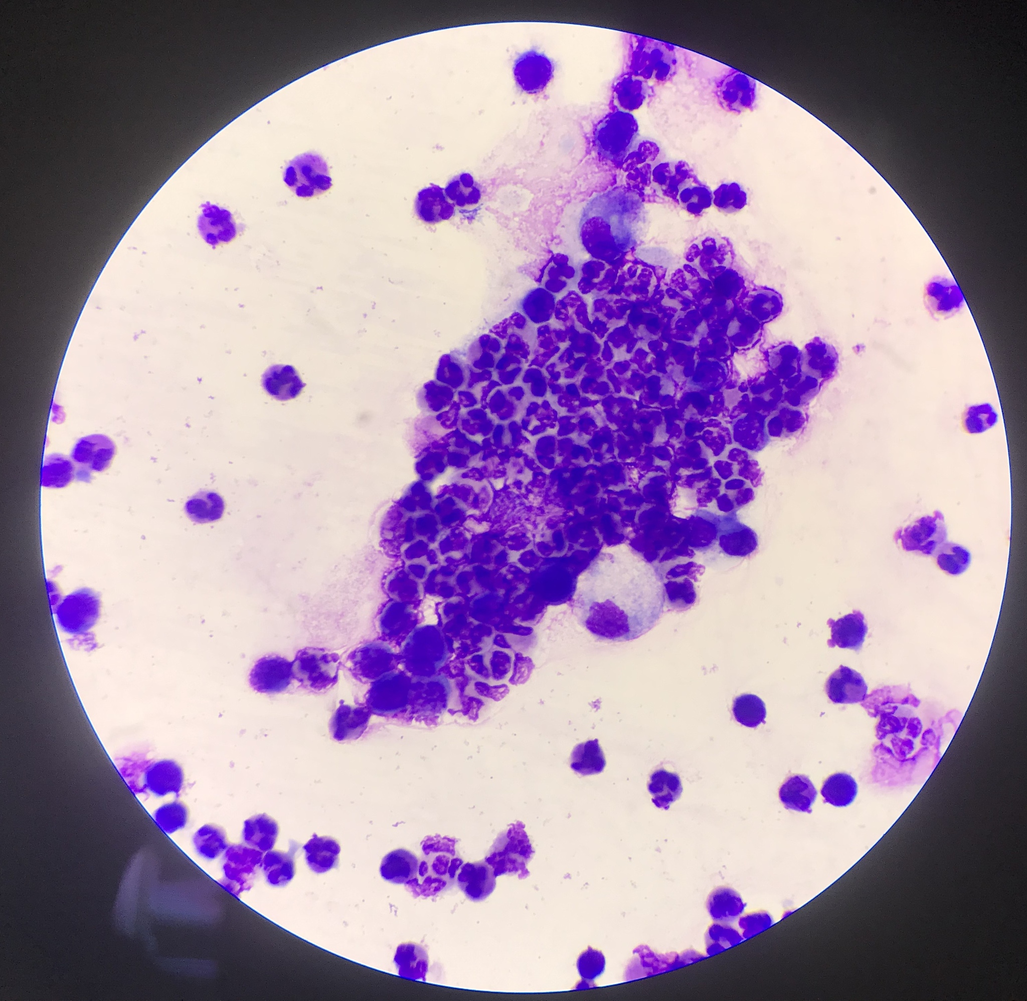 金黄色葡萄球菌促进巨噬细胞分泌炎症因子IL-6