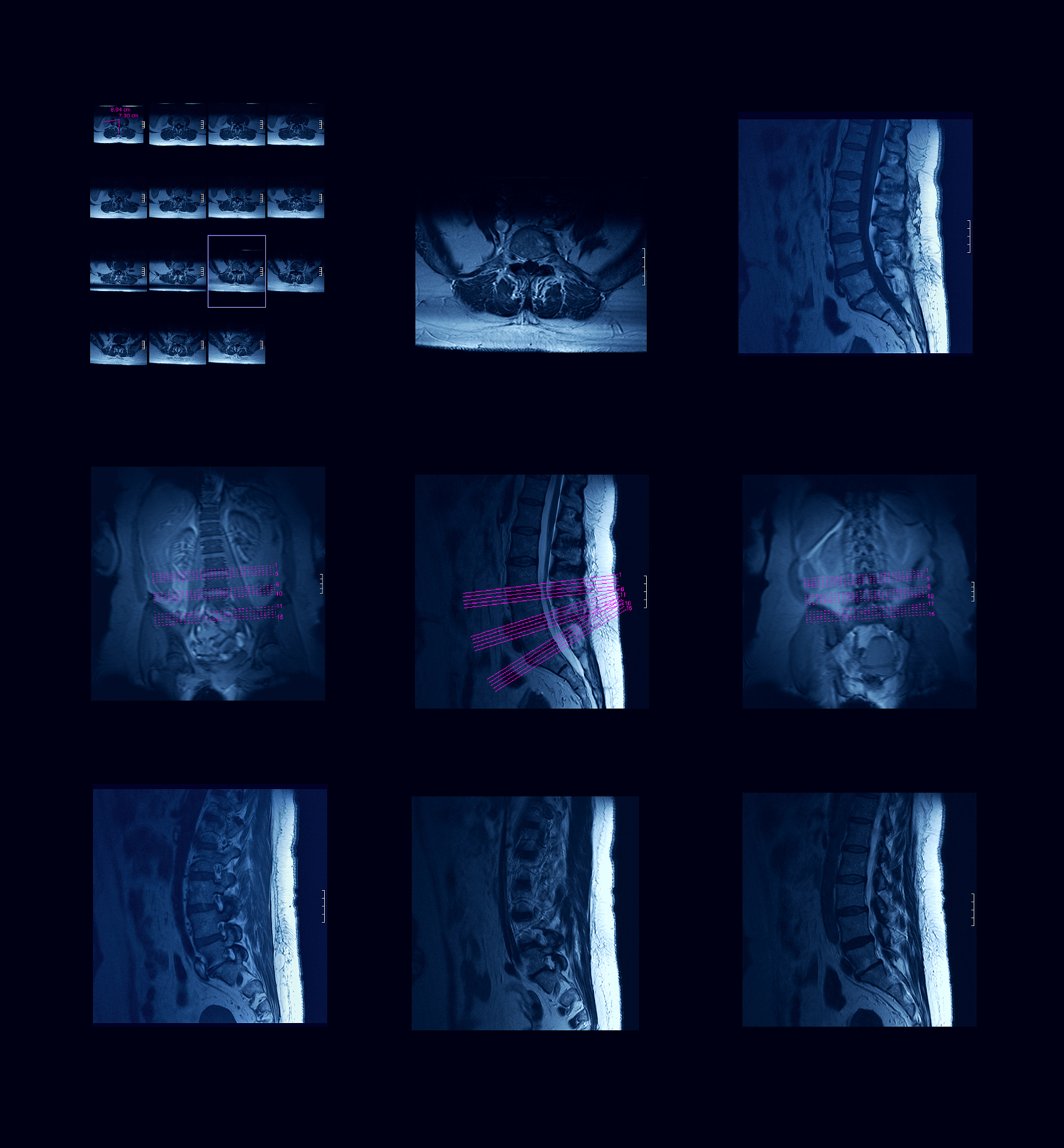 2022年萍乡市卫生学校医学影像技术专业招生简章