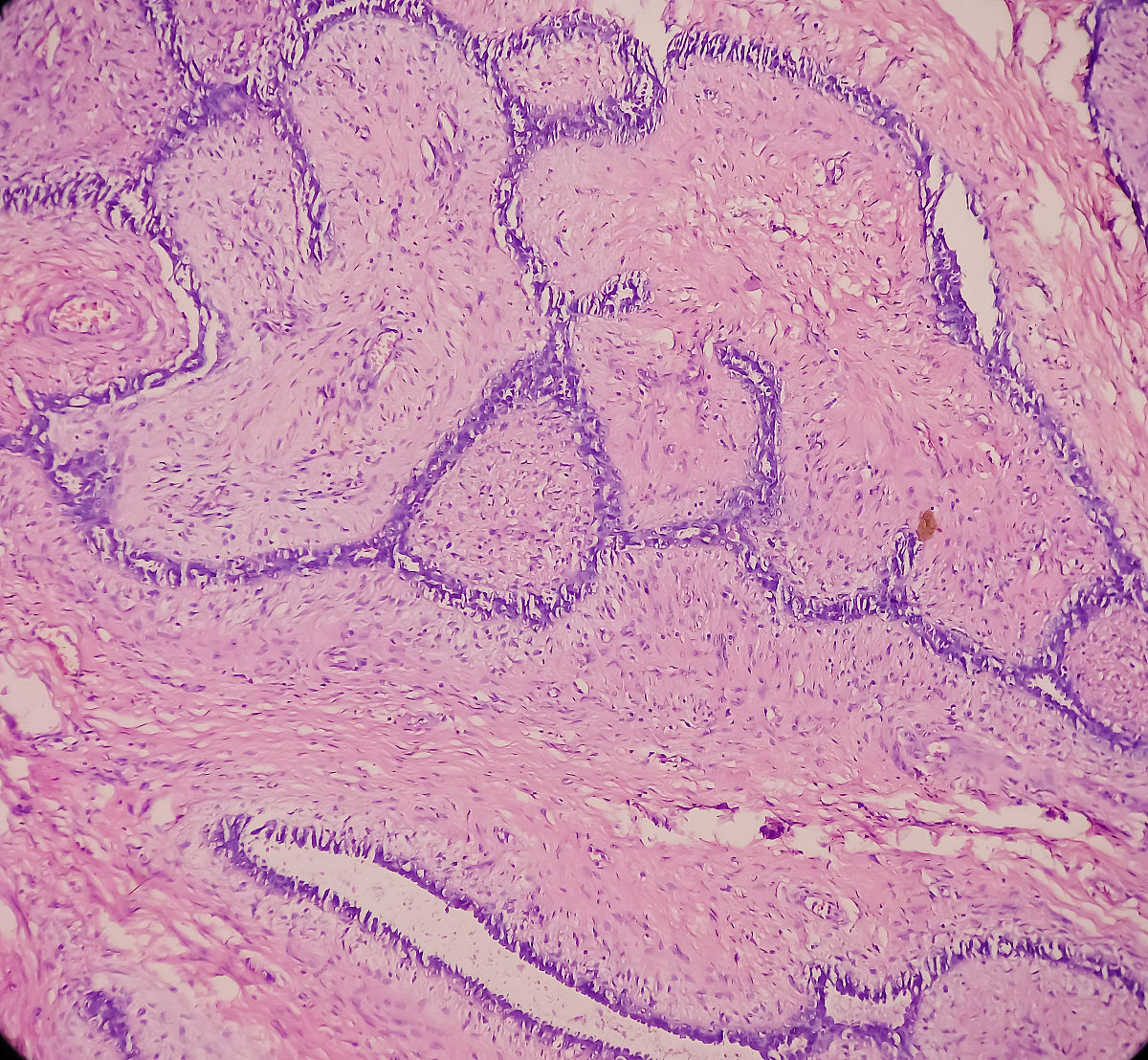 描述对乳腺肿瘤进行分割的结果