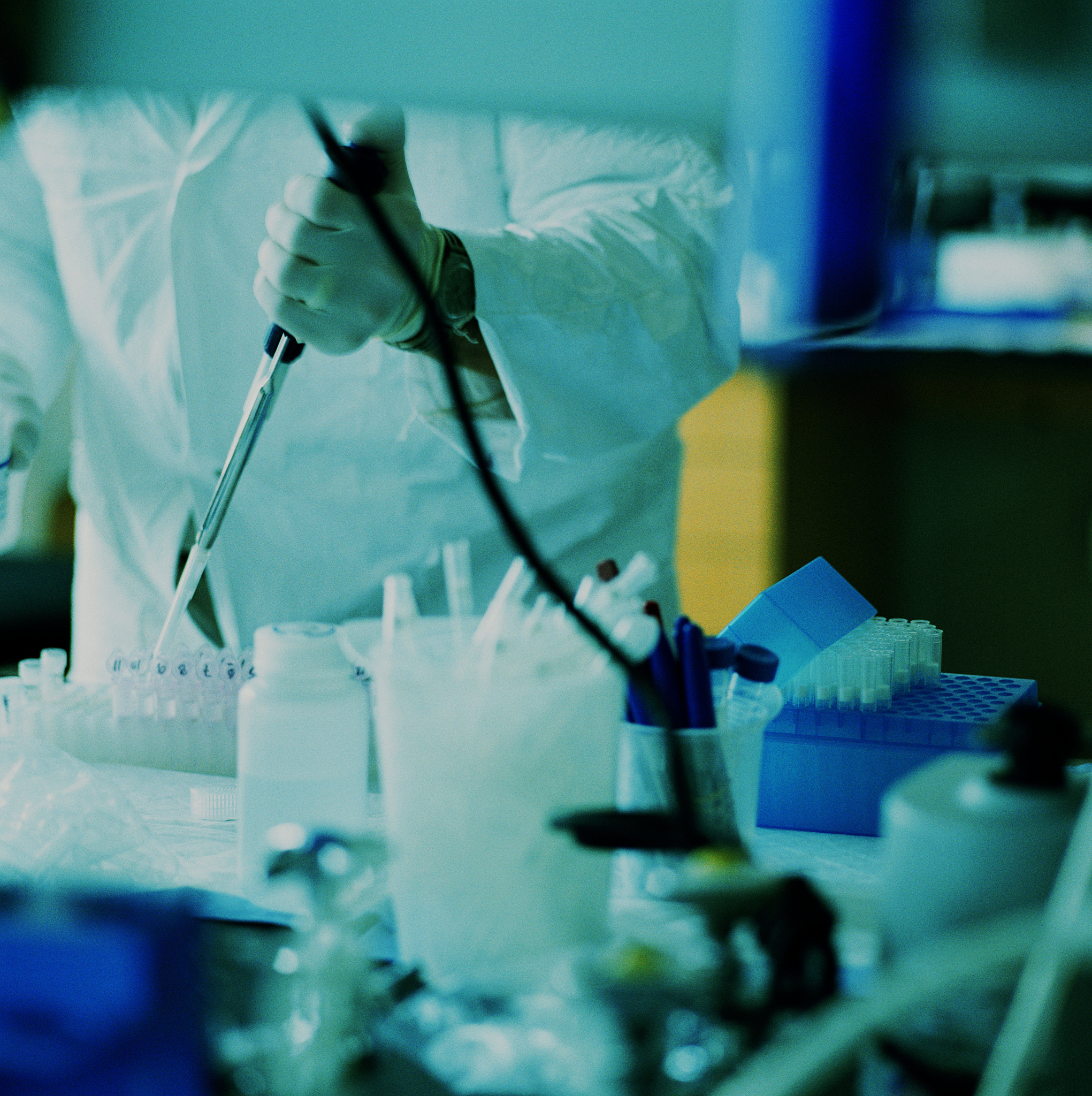 修改这句话在外周血样本中检测肿瘤细胞释放的游离DNAcirculating tumor DNActDNA是另一种有前景的生物标志物。