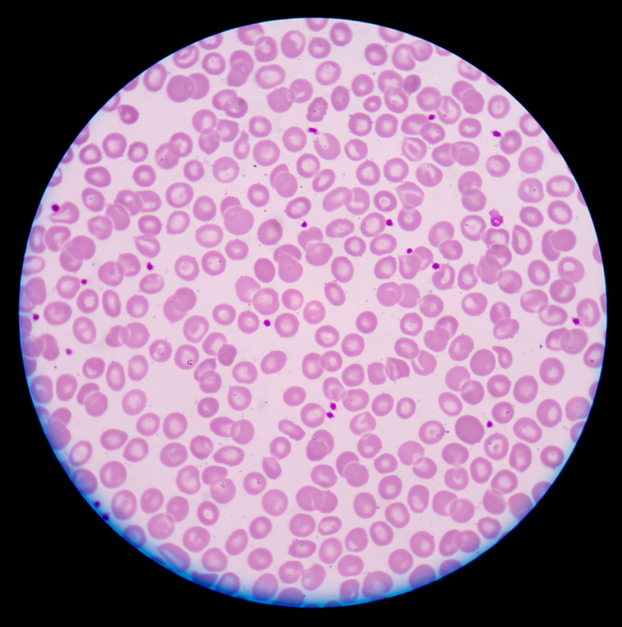 血小板免疫抑制原理