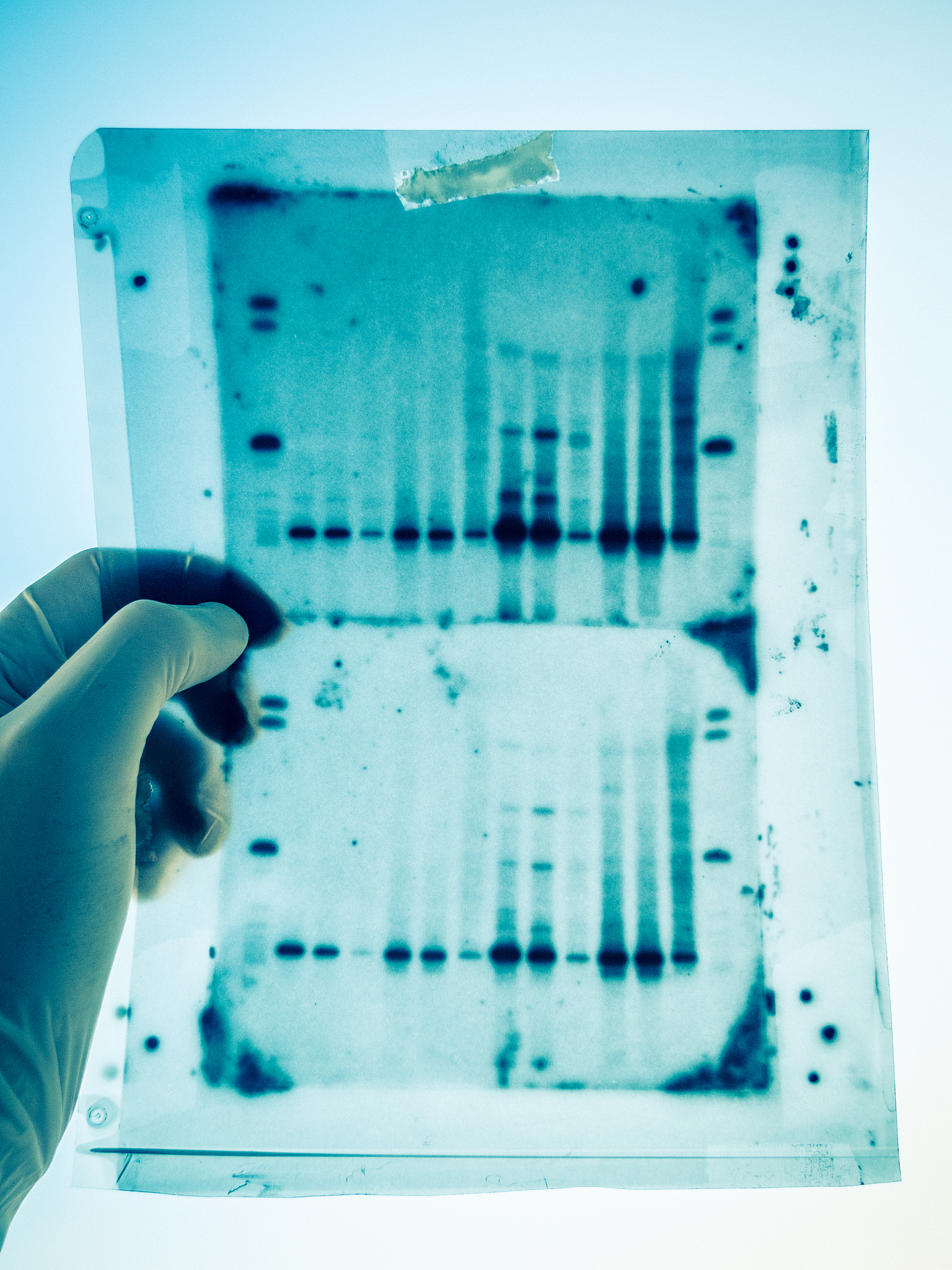 荧光甲基化检测 (LUMA)：限制性酶切与测序技术结合的经典方法