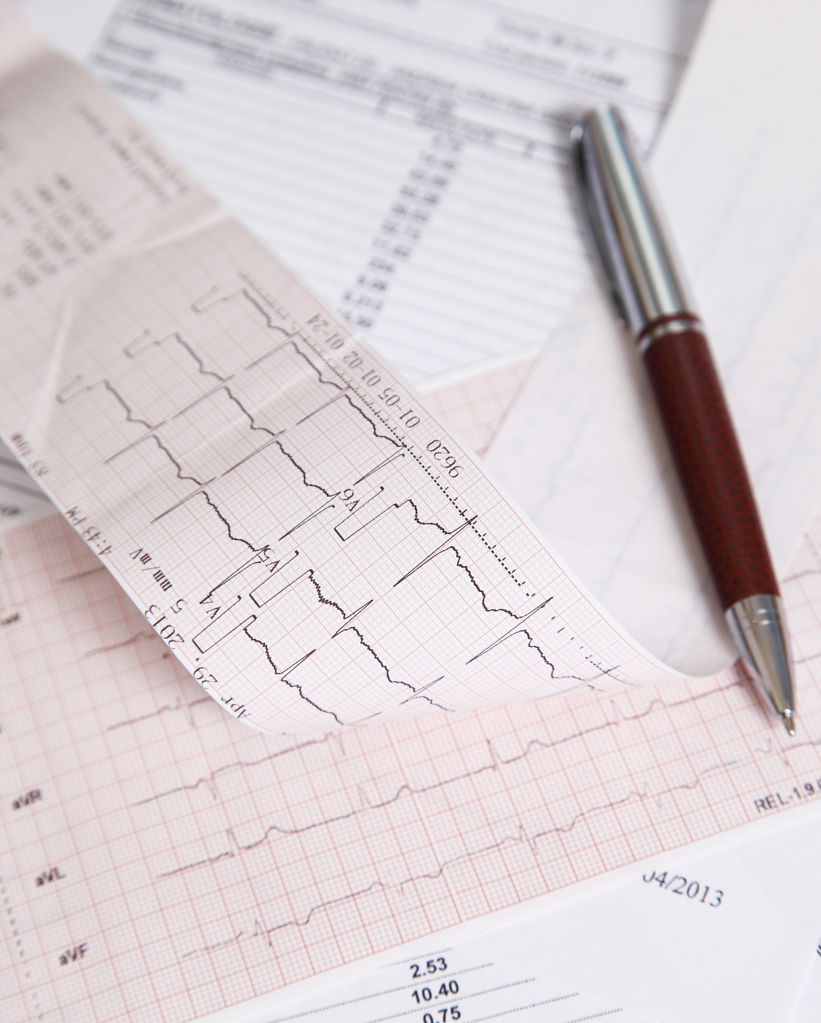 控制系统方框图