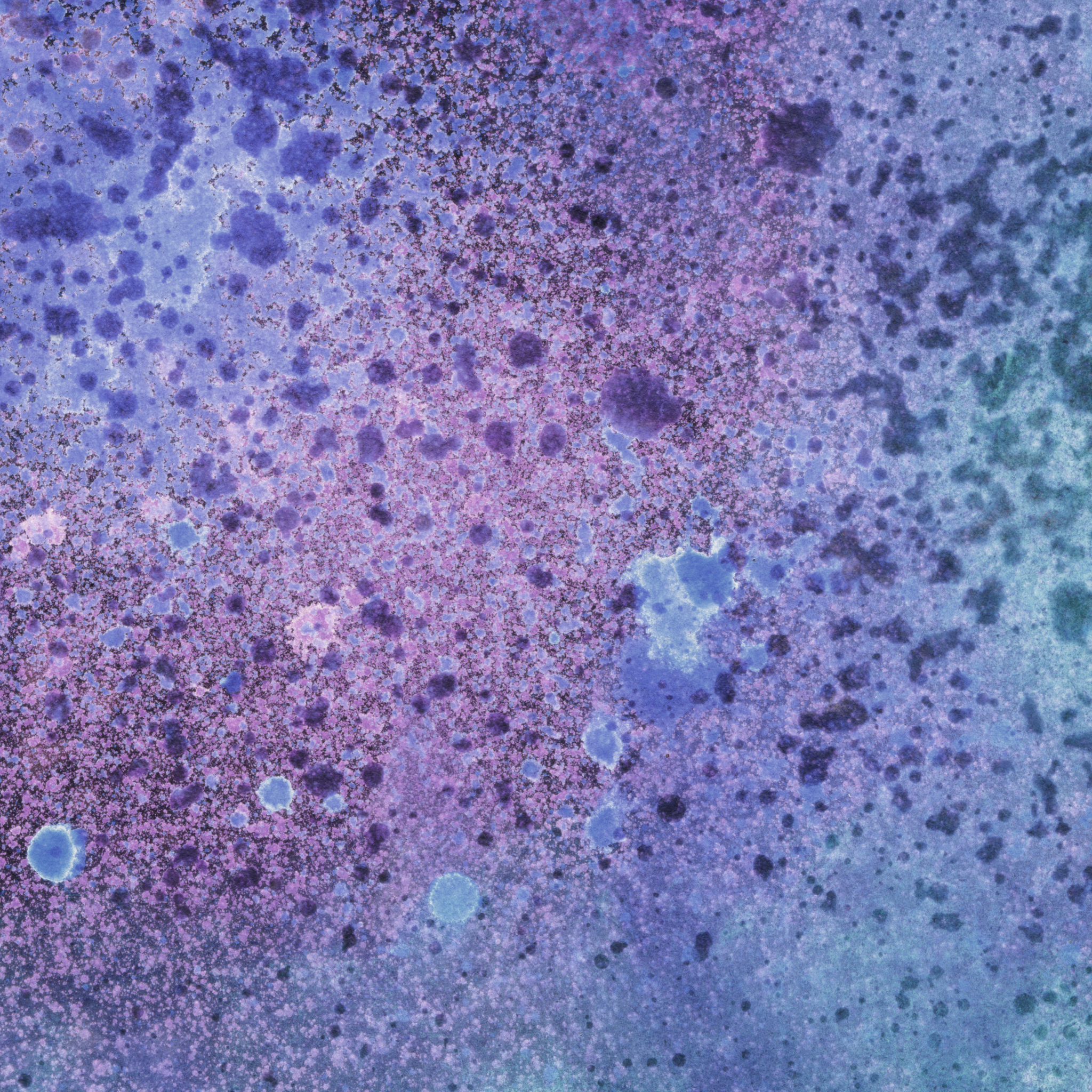 美兰染色：红细胞呈现蓝色