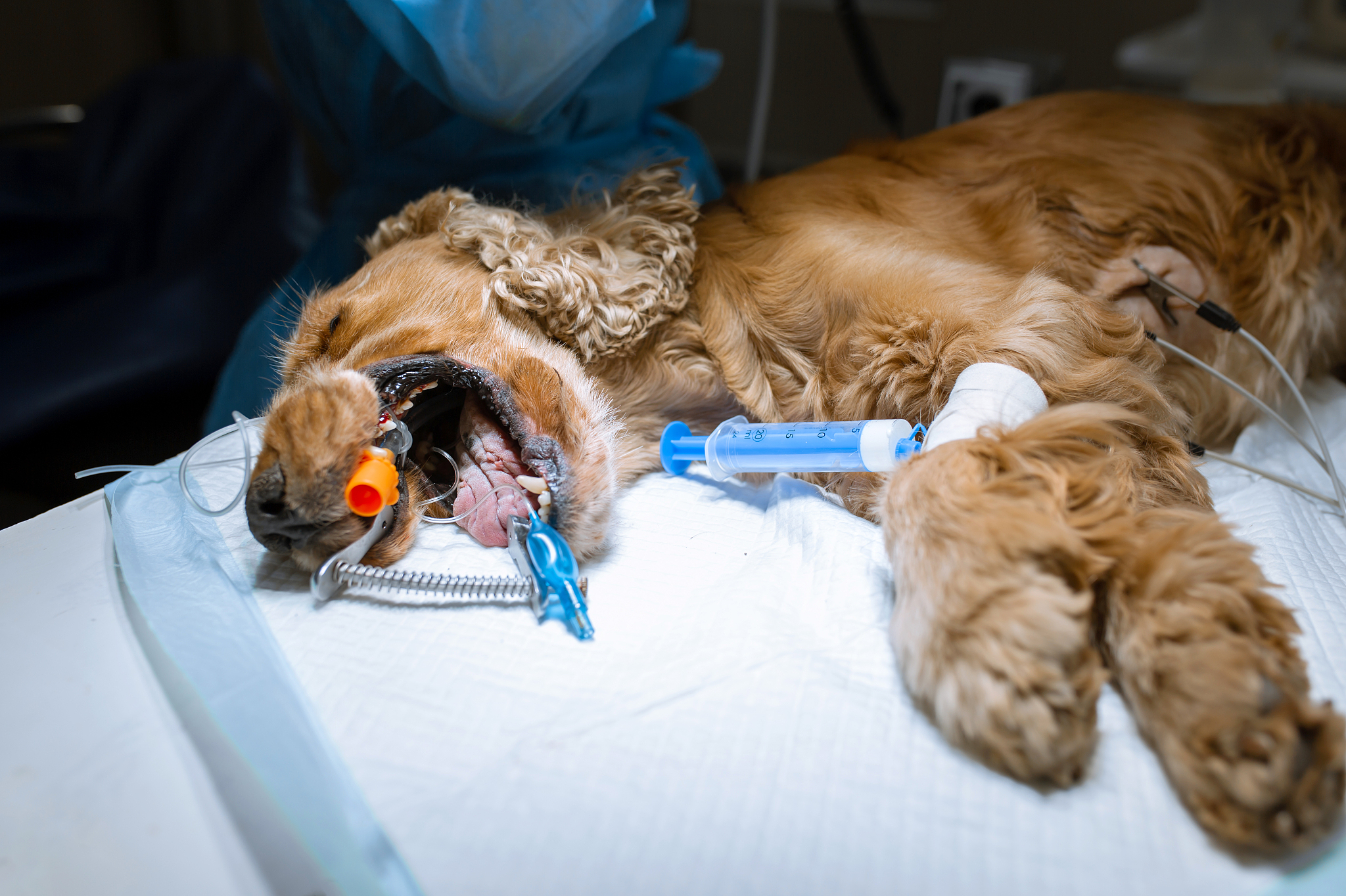 腹部手术后无明显出血的真实液体平衡图