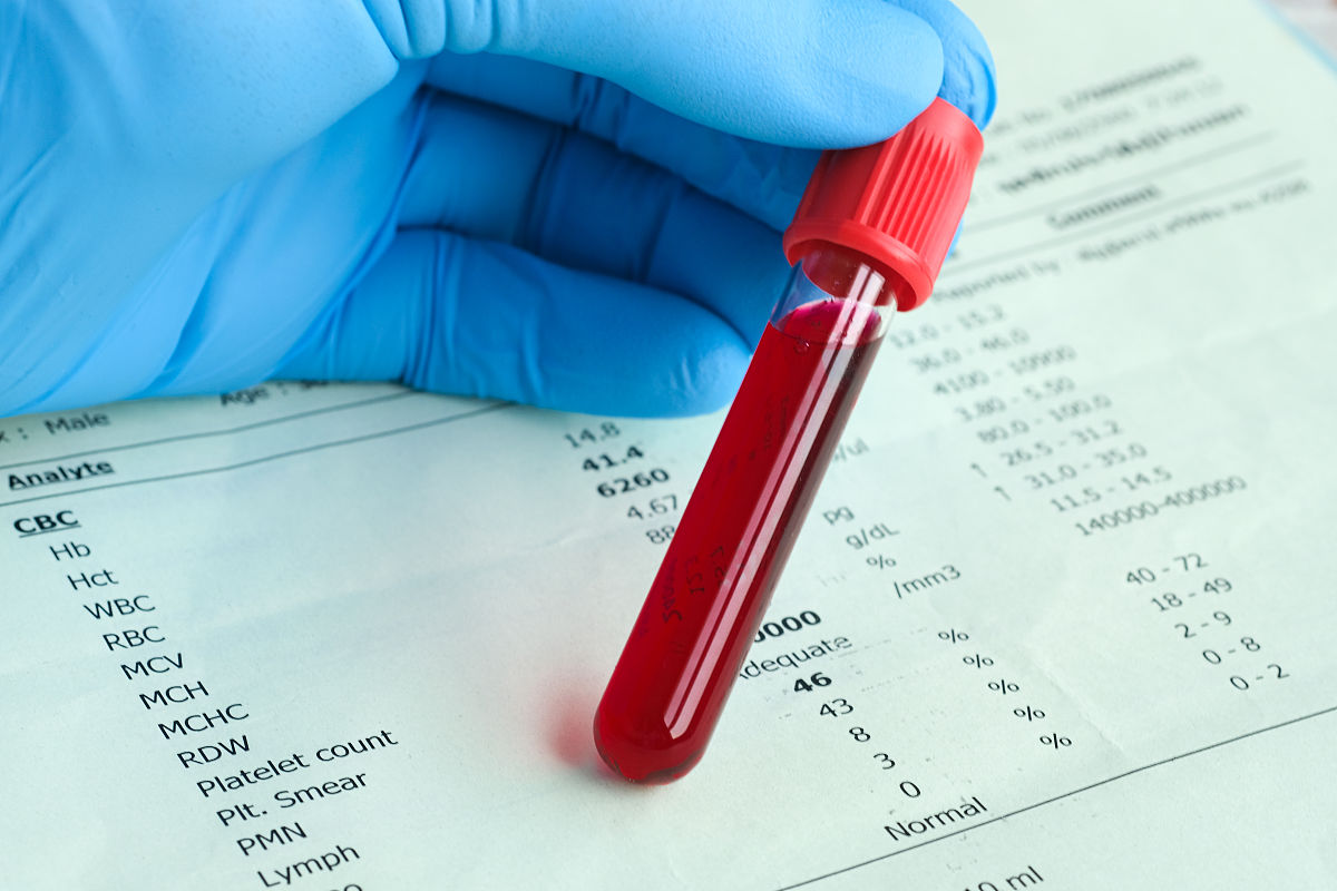 孕妇血液样本检测：用途及意义