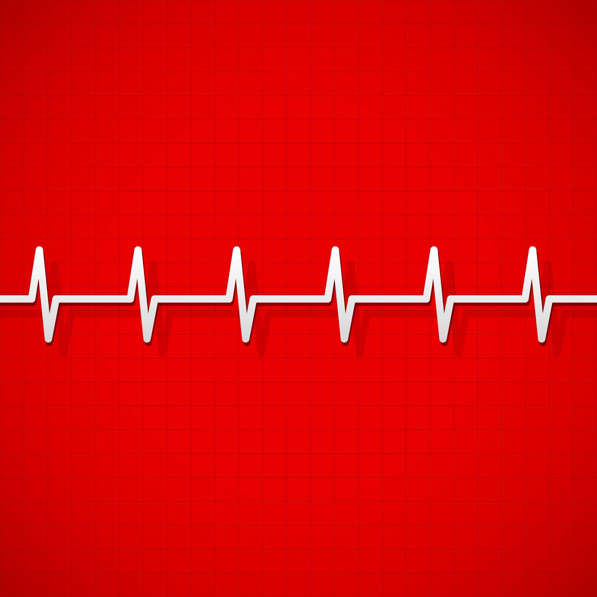 心率快慢的医学解释：正常值、心动过速、心动过缓等