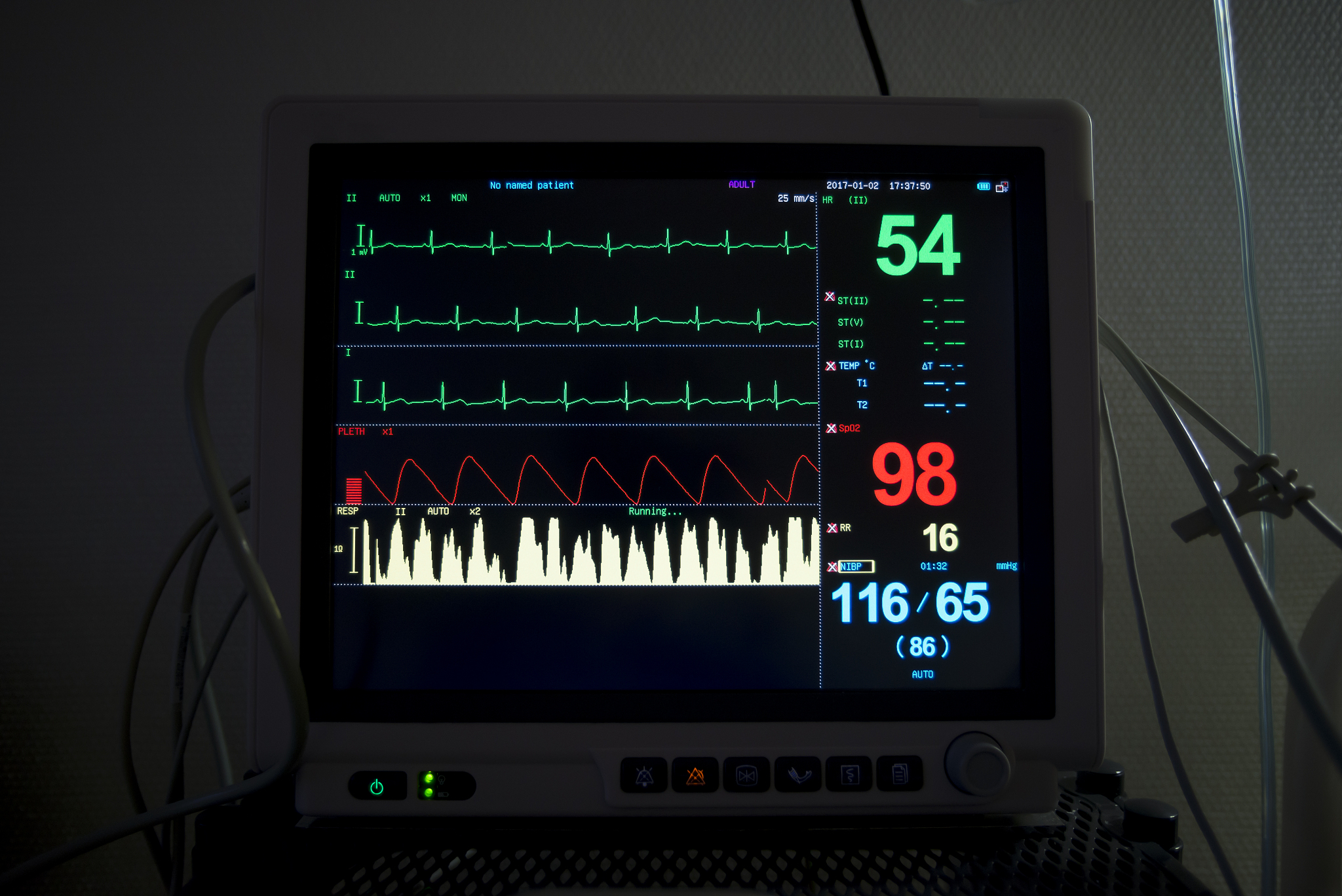 基于单片机的心率监测系统设计写一篇2023年研究背景