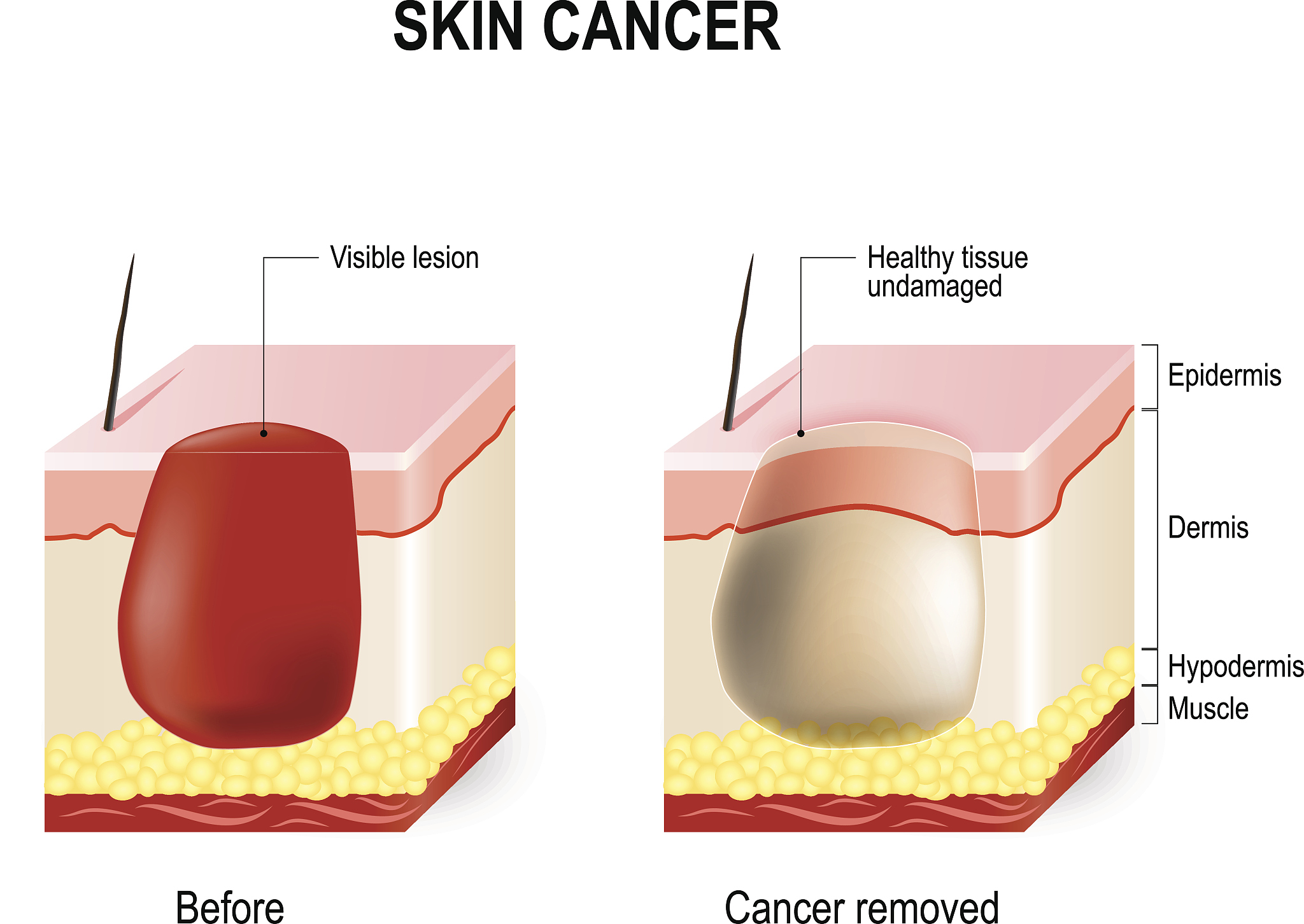 非洲爪蟾是如何应用于药物筛选的
