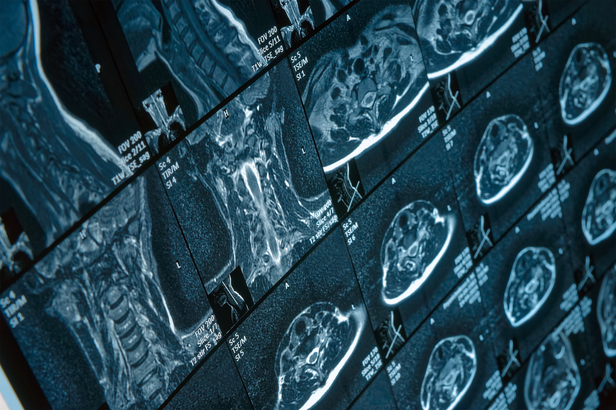 按照上述和 脑部专用正电子发射型计算机断层显像PET设备相关的大纲生成PPT内容每一页需要包括以下内容：-标题；-关键要点；-正文内容。