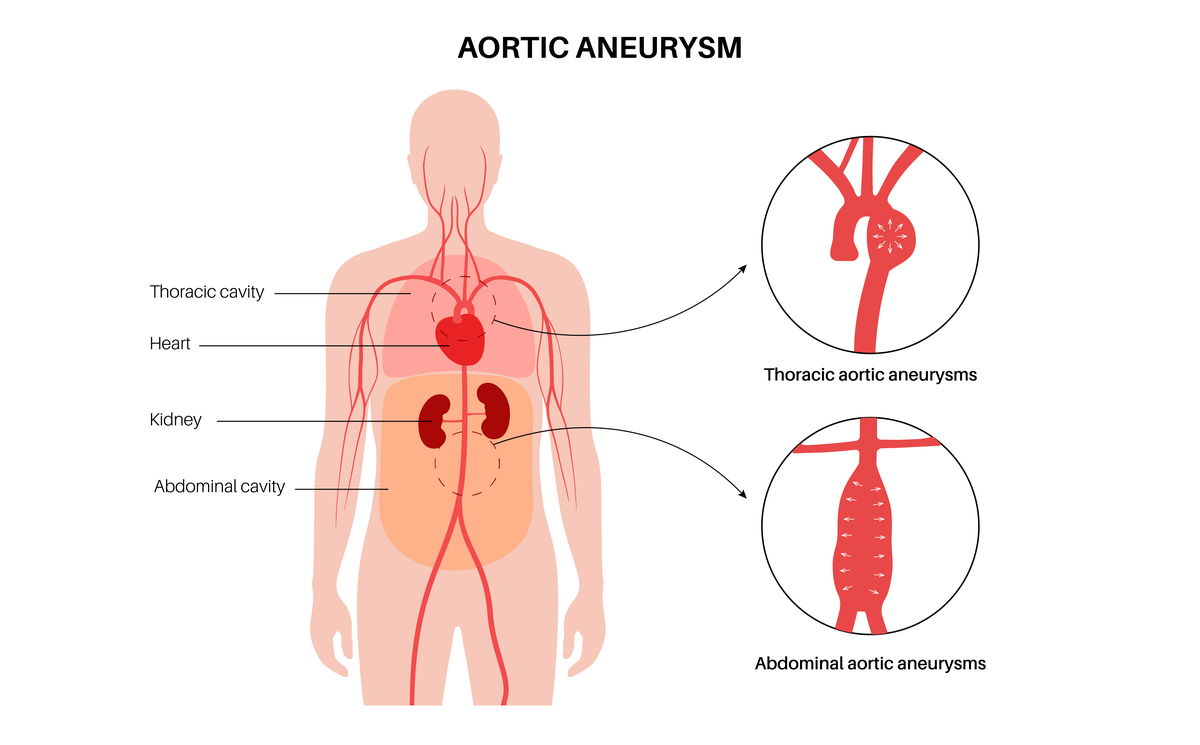只有一个心脏,人还能活吗? 只有一个心脏,人还能活吗?