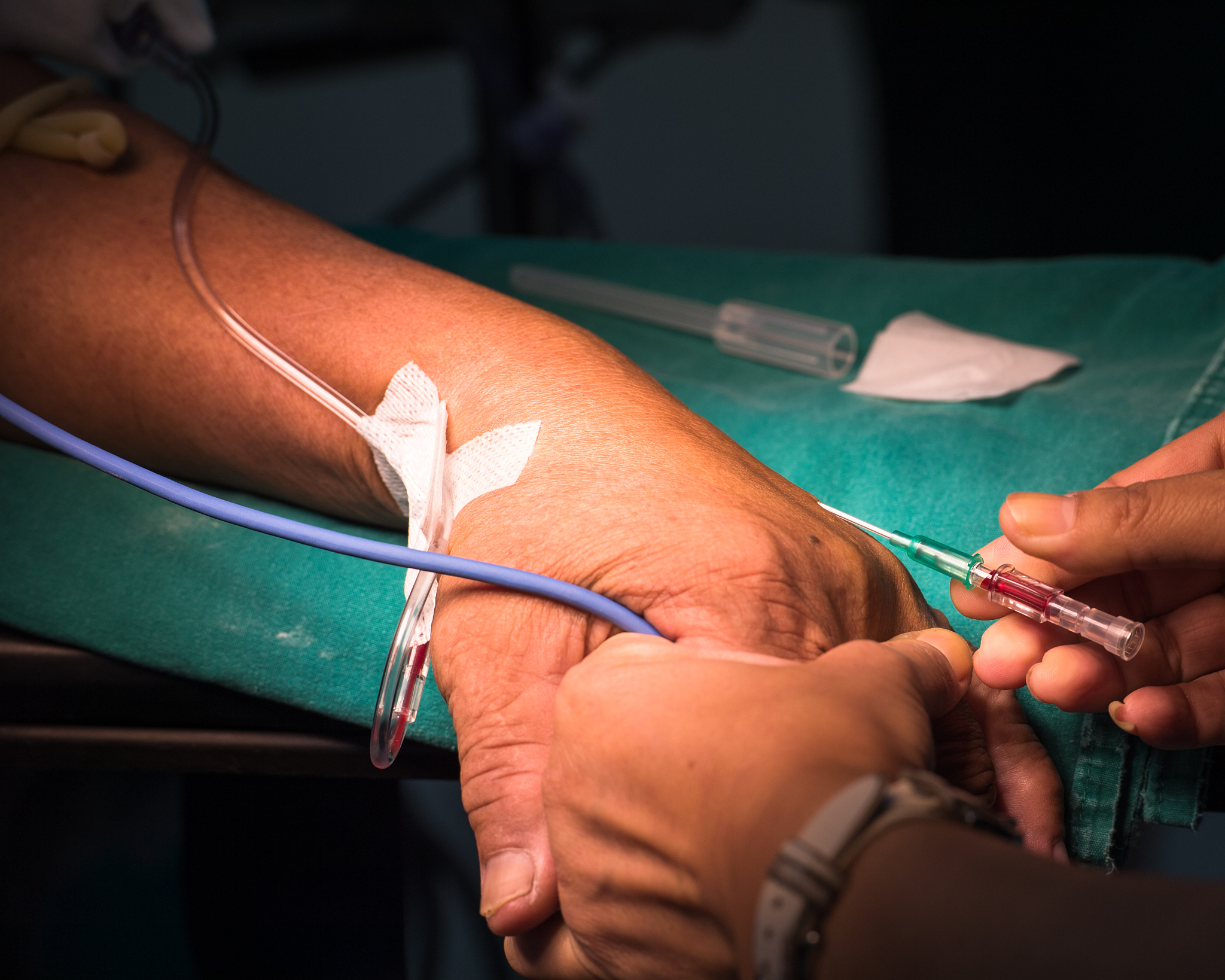 open intravenous fluid