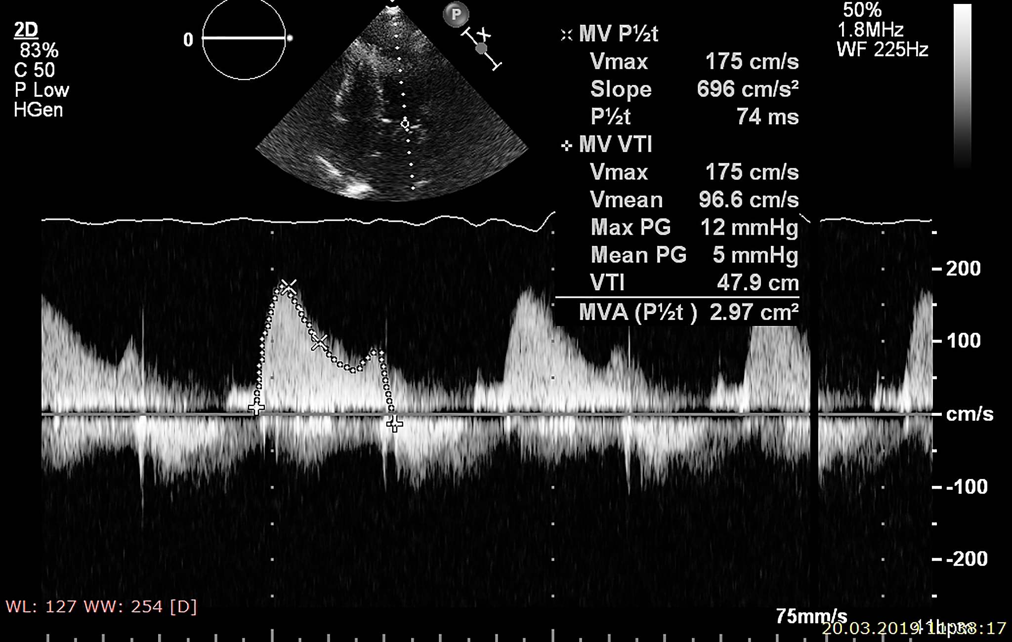 有关水下爆炸冲击波压力与距离的matlab计算代码