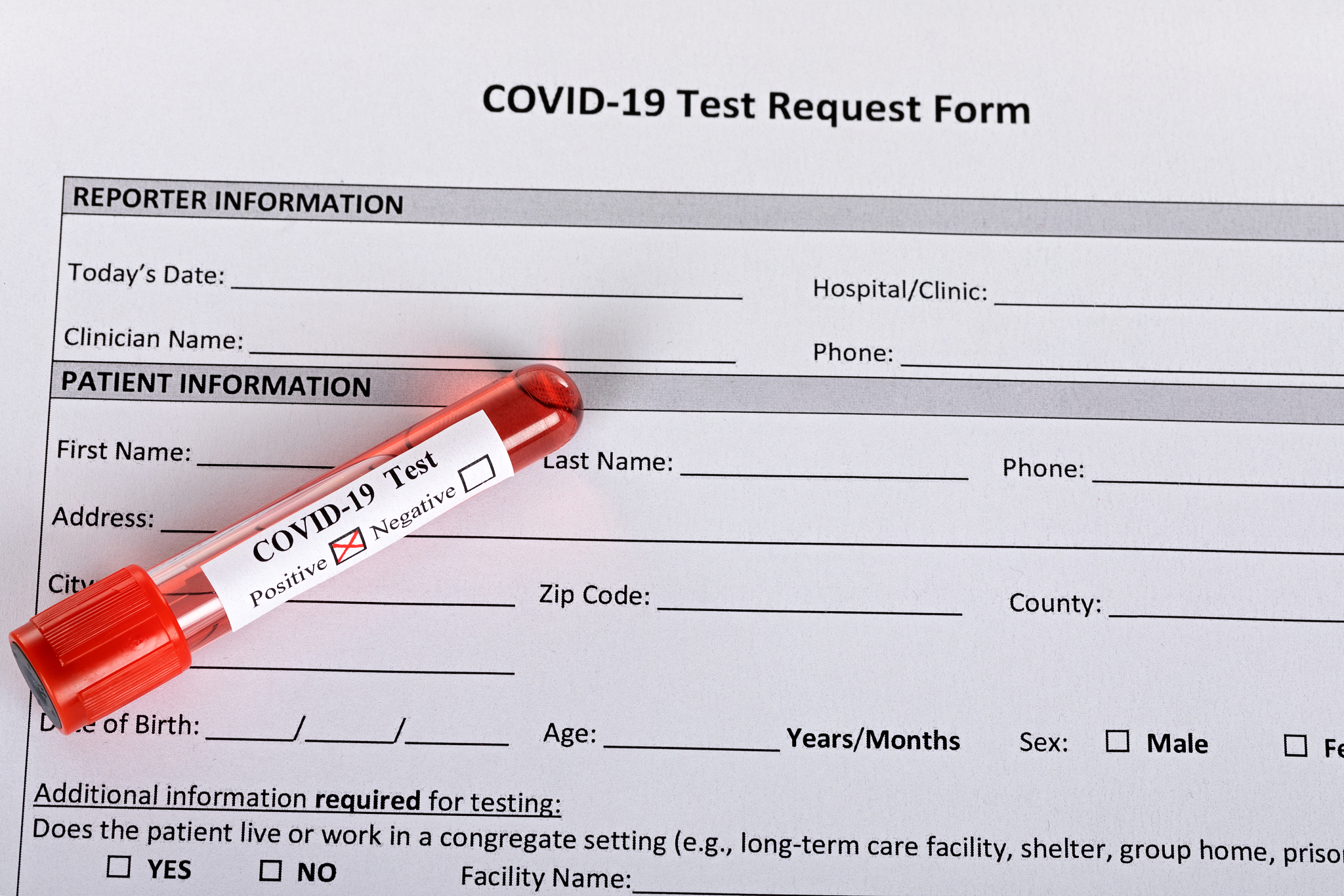 LGI1抗体检测方法: 诊断抗LGI1脑炎的重要工具