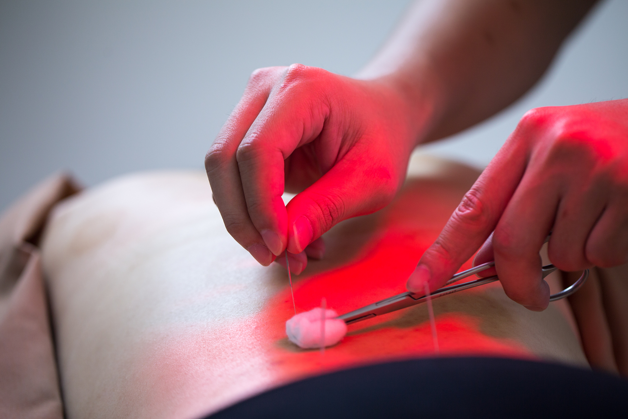 2021年针灸推拿就业前景分析：机遇与挑战并存