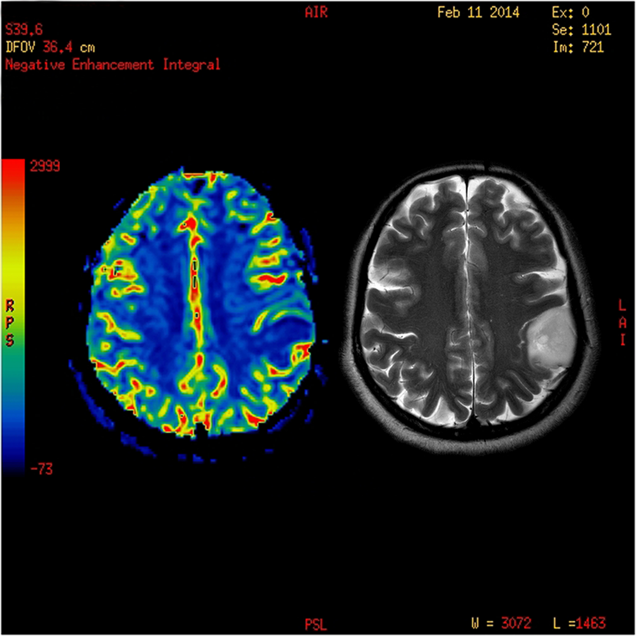 International MICCAI Brainlesion Workshop中文介绍它是几类会议？