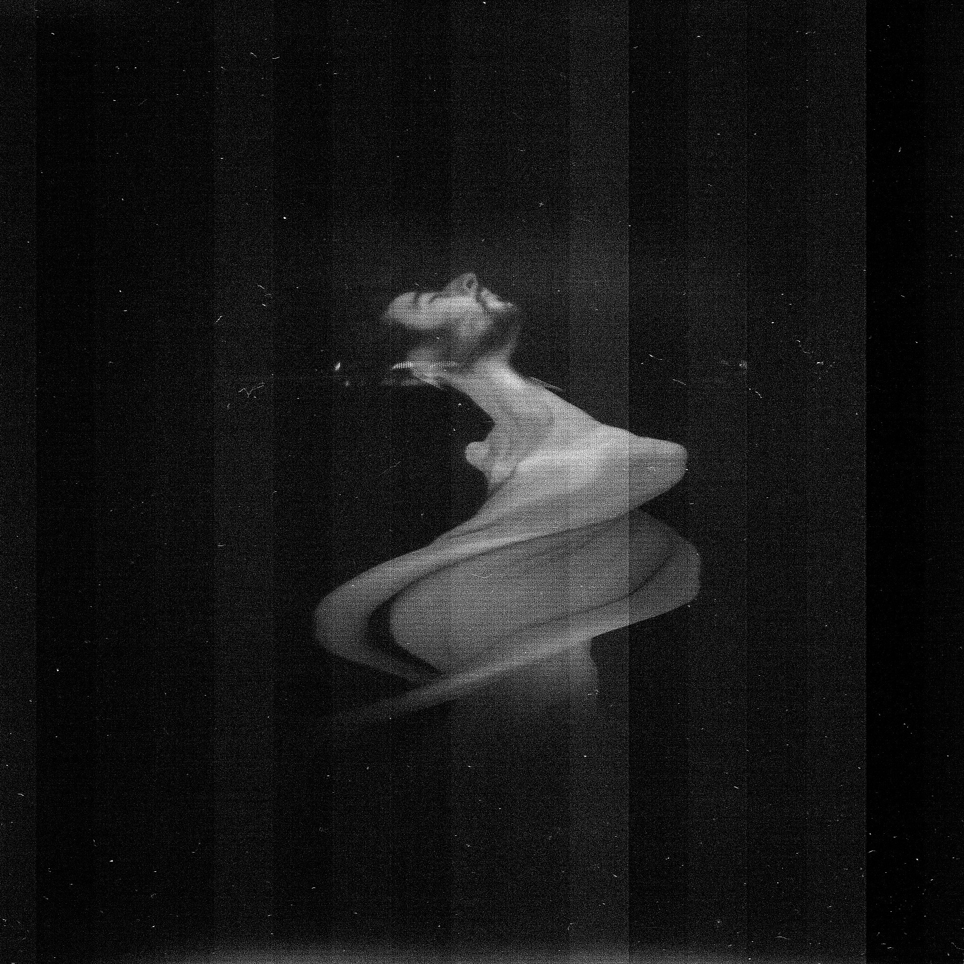 特重度烧伤疼痛护理：缓解疼痛，促进康复