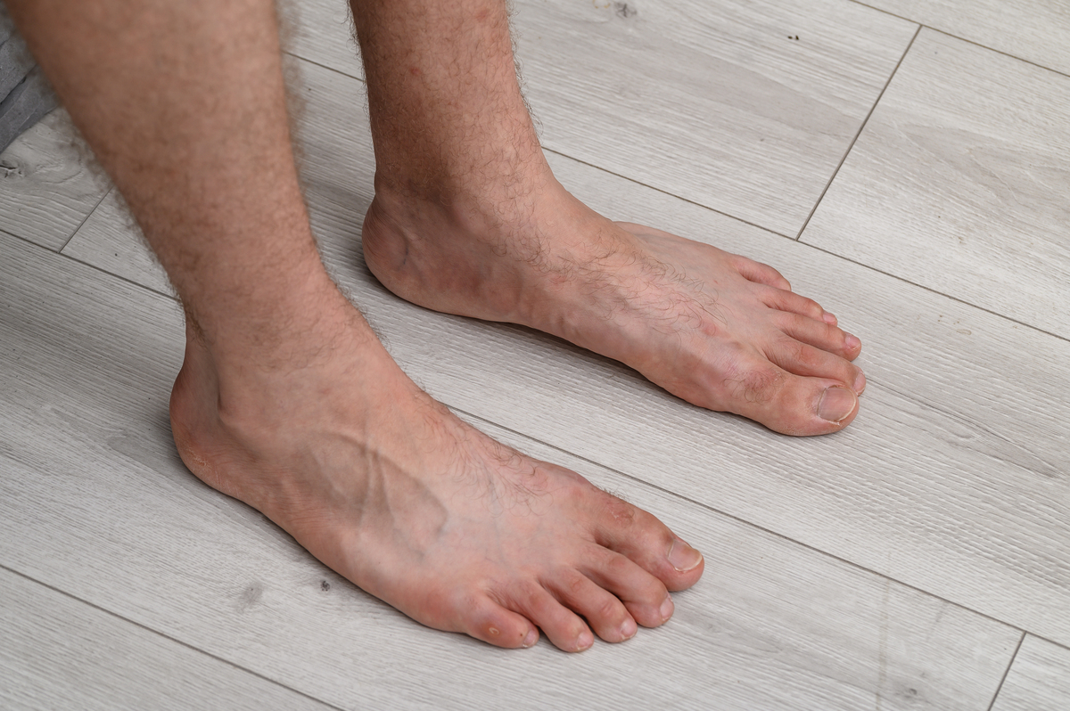 行走时抬起脚跟时脚底中间痛