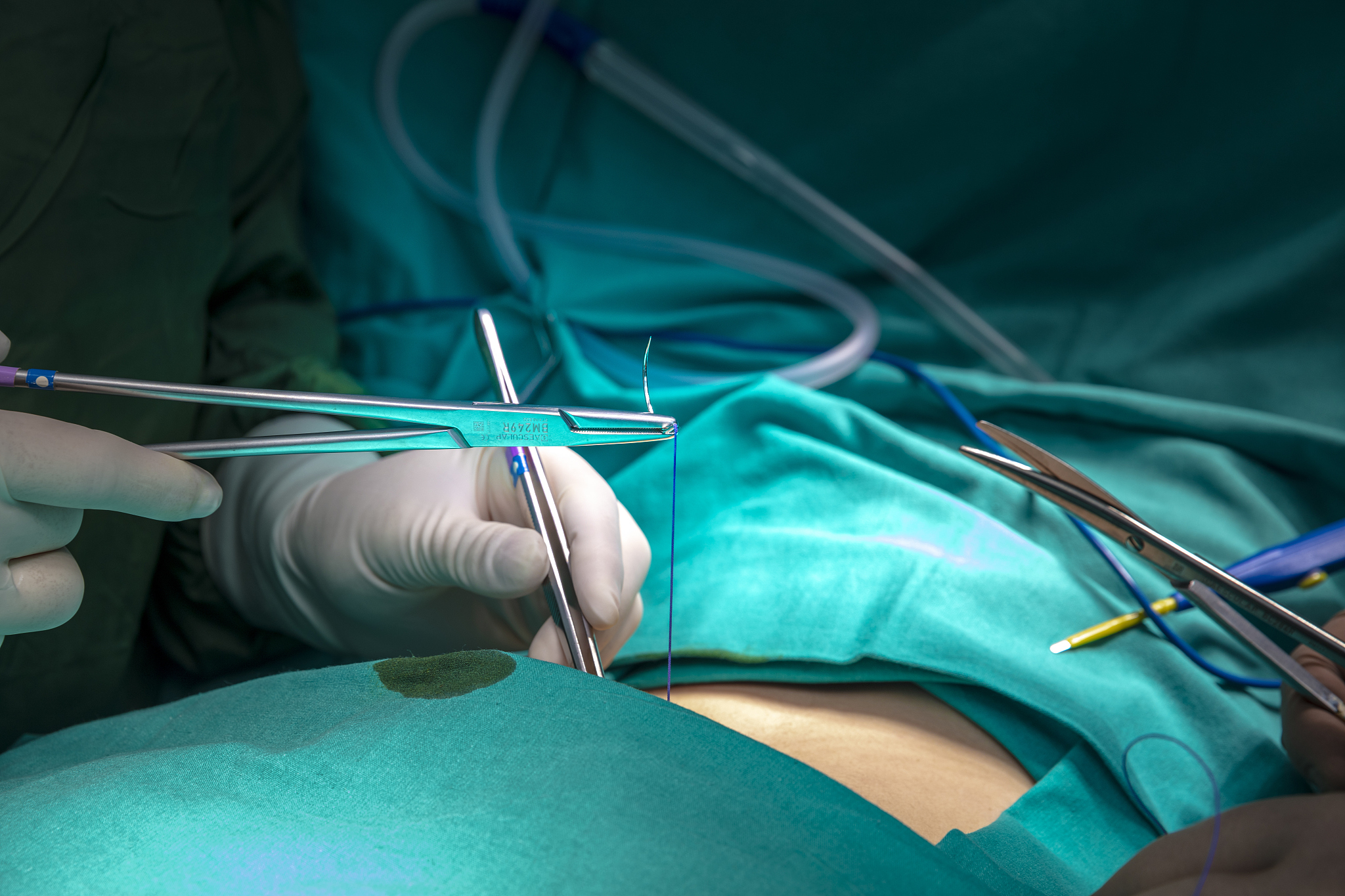 doctor make a surgical stitch