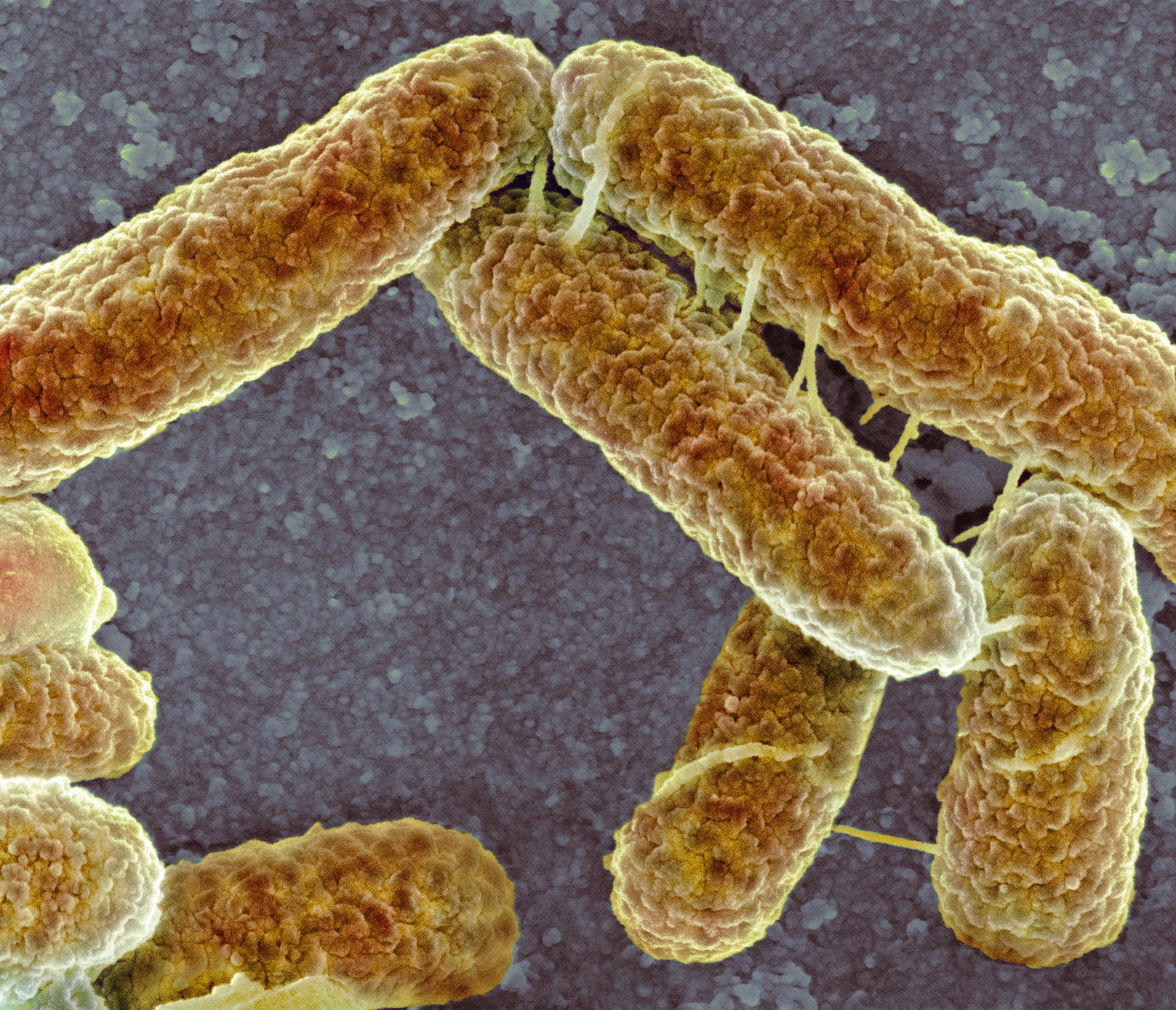 通过研究成年小鼠肠道粪便菌群的关系发现成年小鼠通过粪便将萨特氏菌细菌传播给彼此而母鼠在小鼠出生后不久将萨特氏菌属直接传播给它们的后代从而传递了这种低lgA的特征。不改变意思换个说法