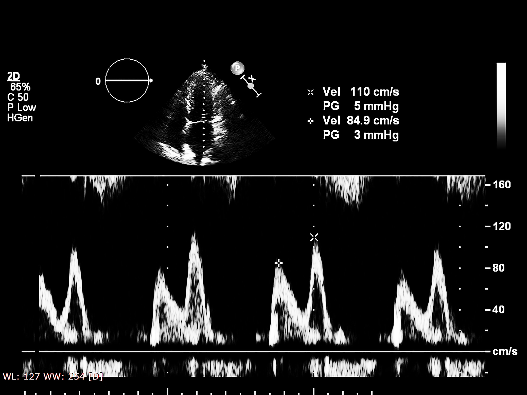 频率密度计算方法详解：快速掌握信号频率分布
