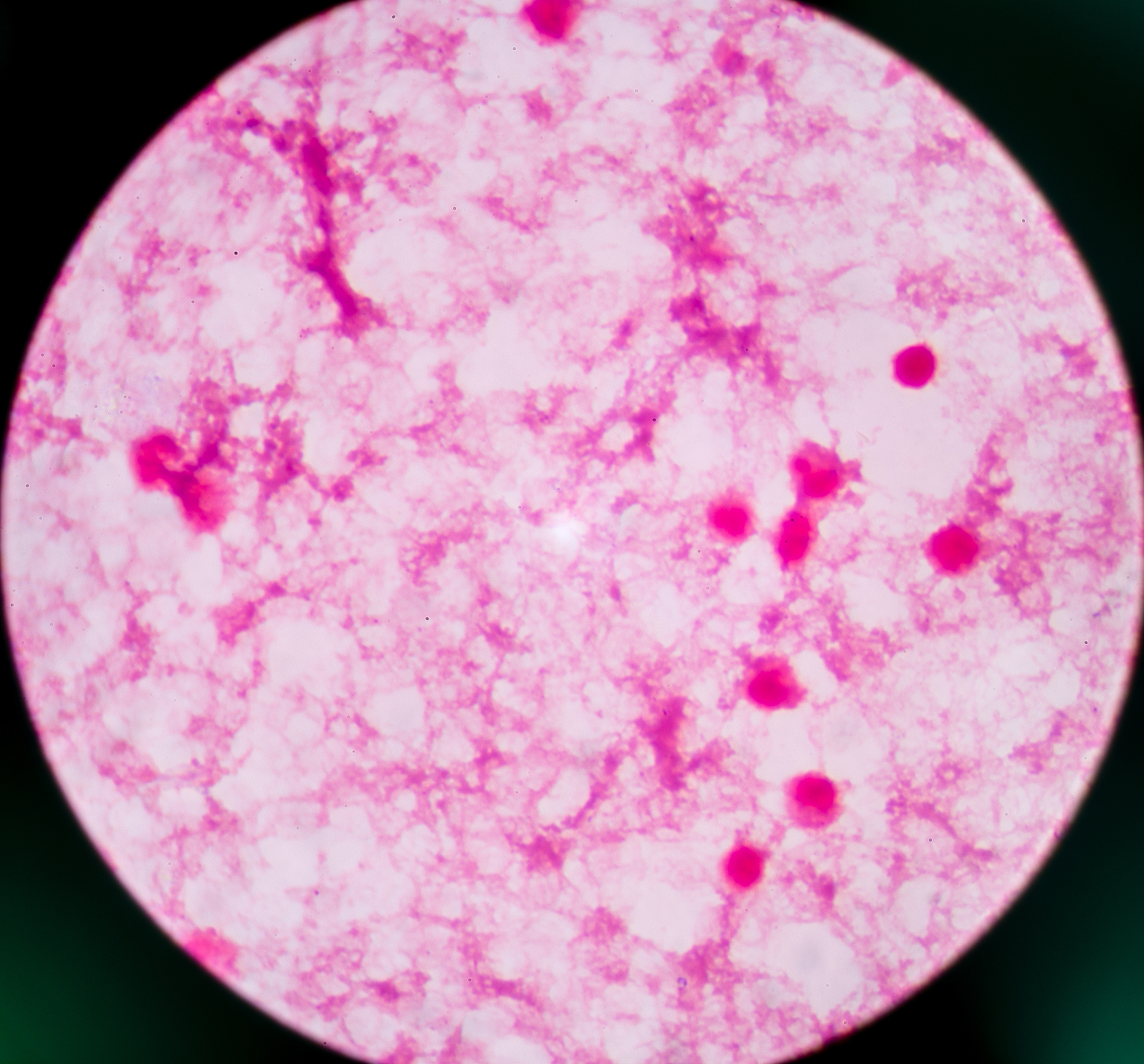 重庆市医药学校医学检验专业：就业前景、学习难度及未来发展