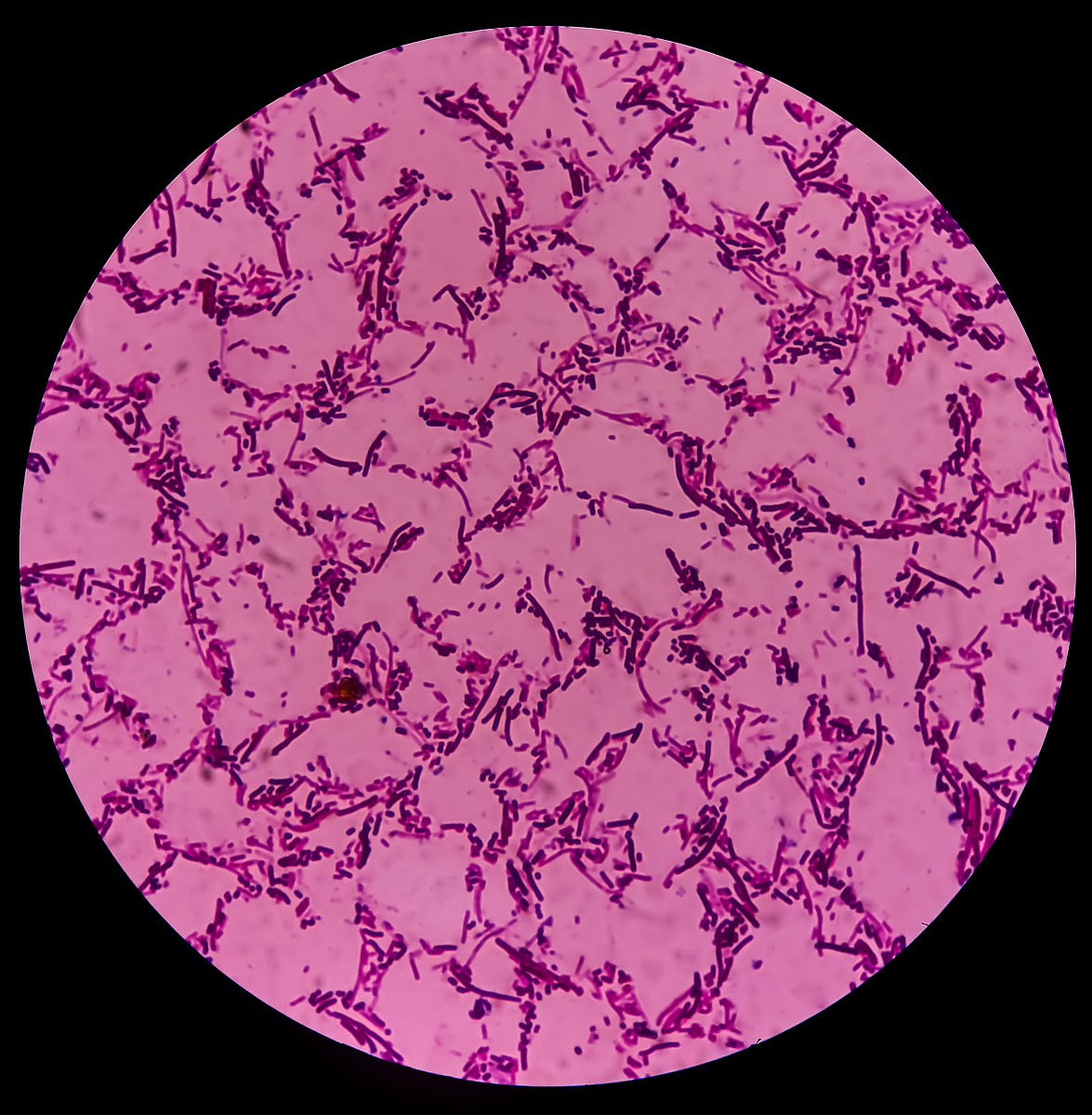 沙门氏菌中毒症状：常见表现及预防措施 - 权威指南