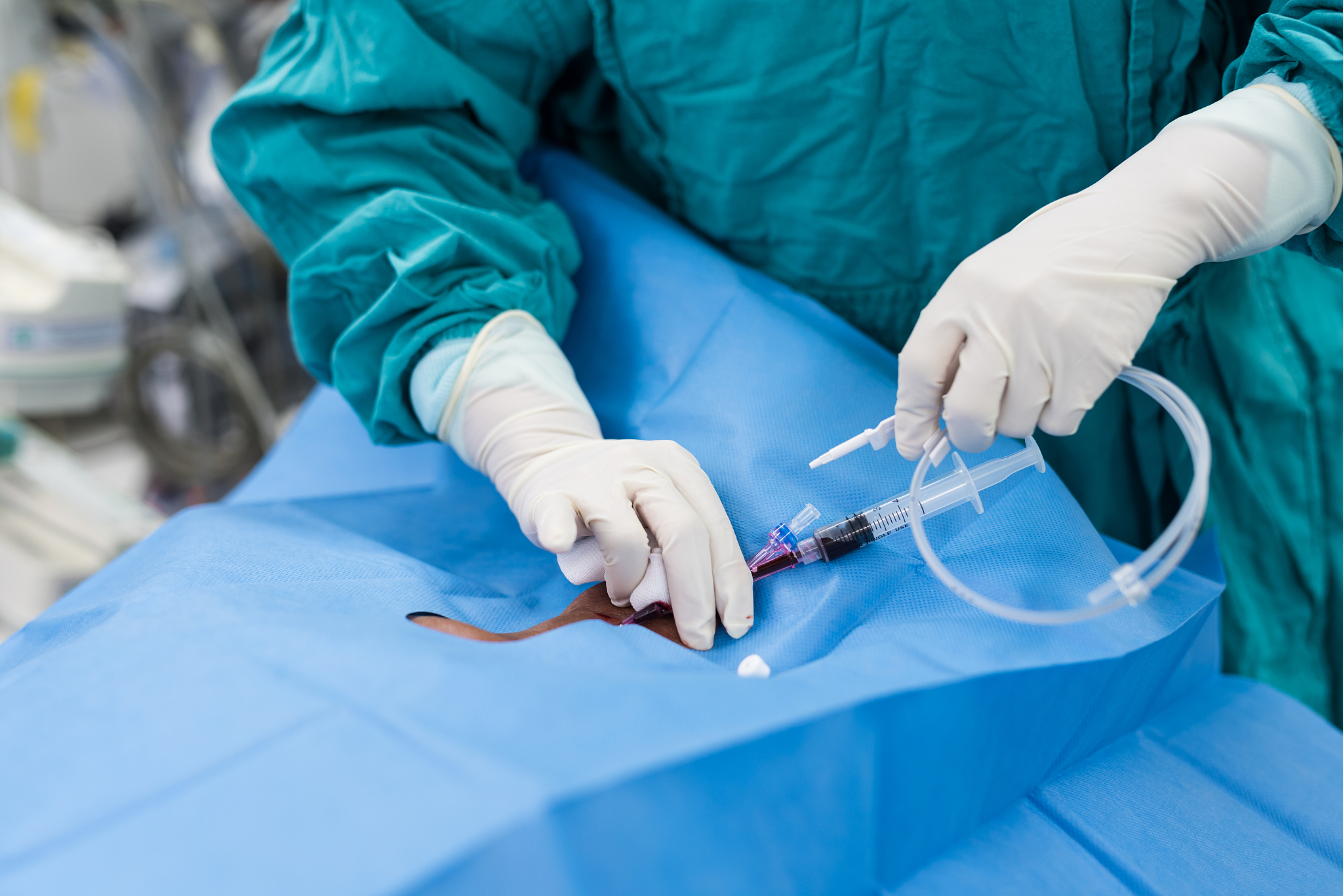 central venous pressure procedure