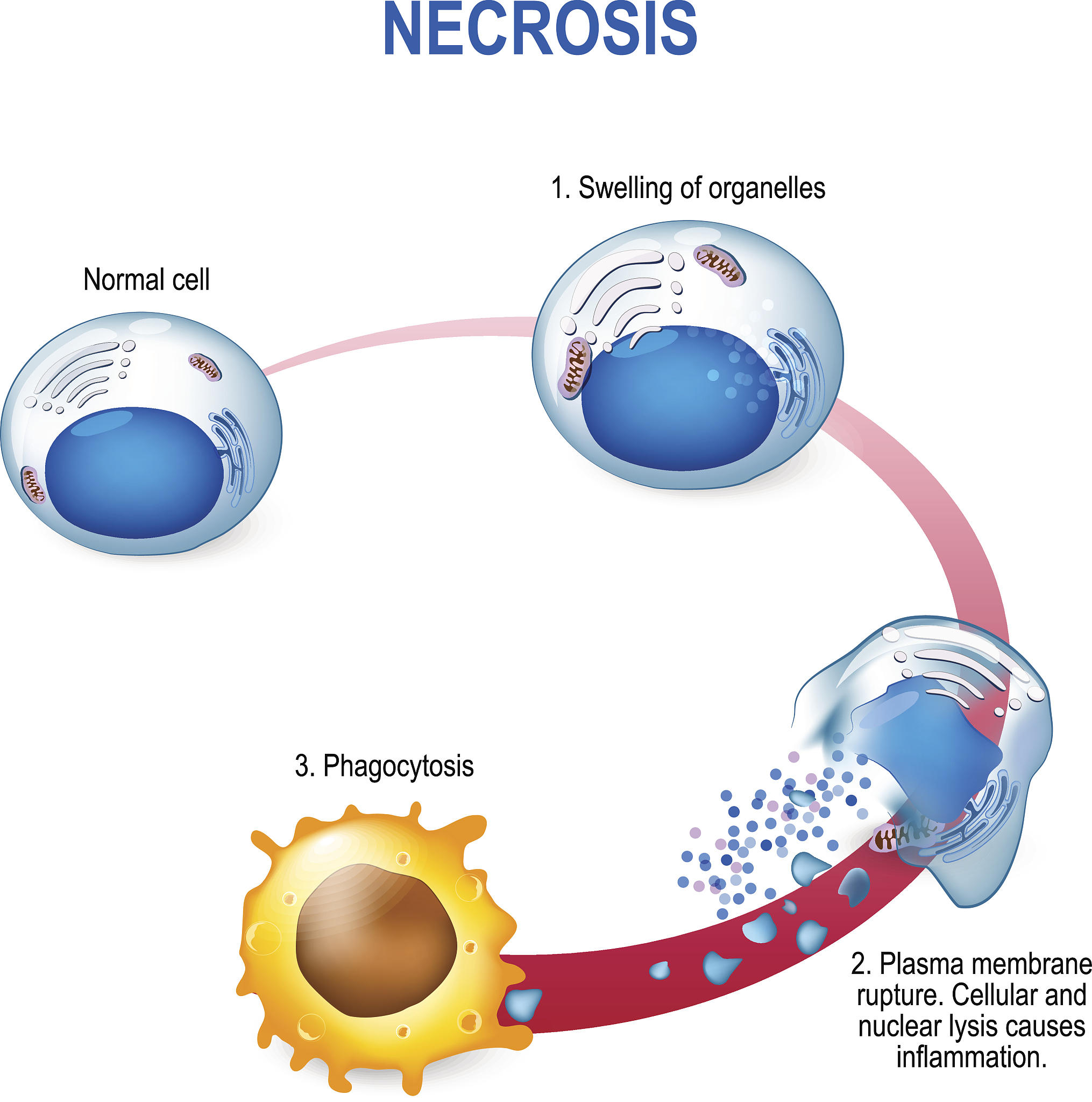 写300字描述SH3RF2与肿瘤DNA损伤修复研究进展
