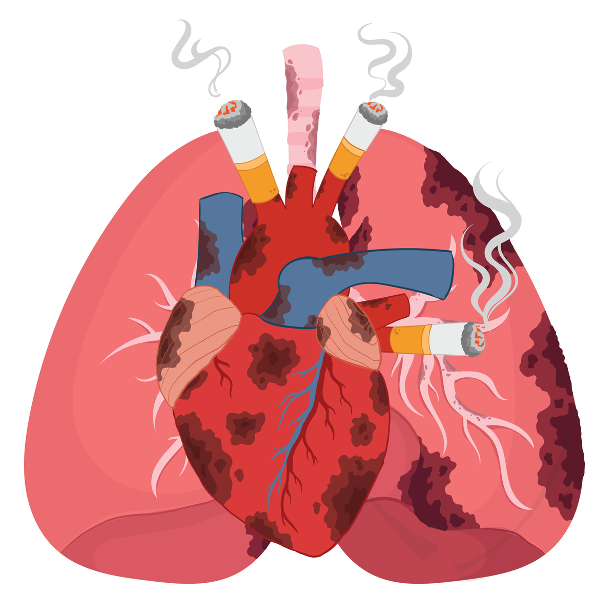 心脏年龄偏大怎么办？