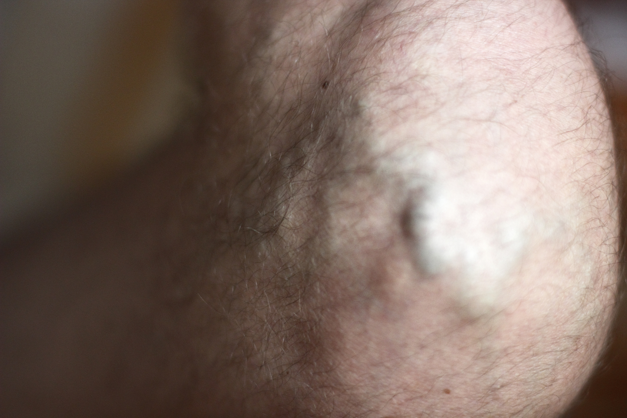 human veins on leg