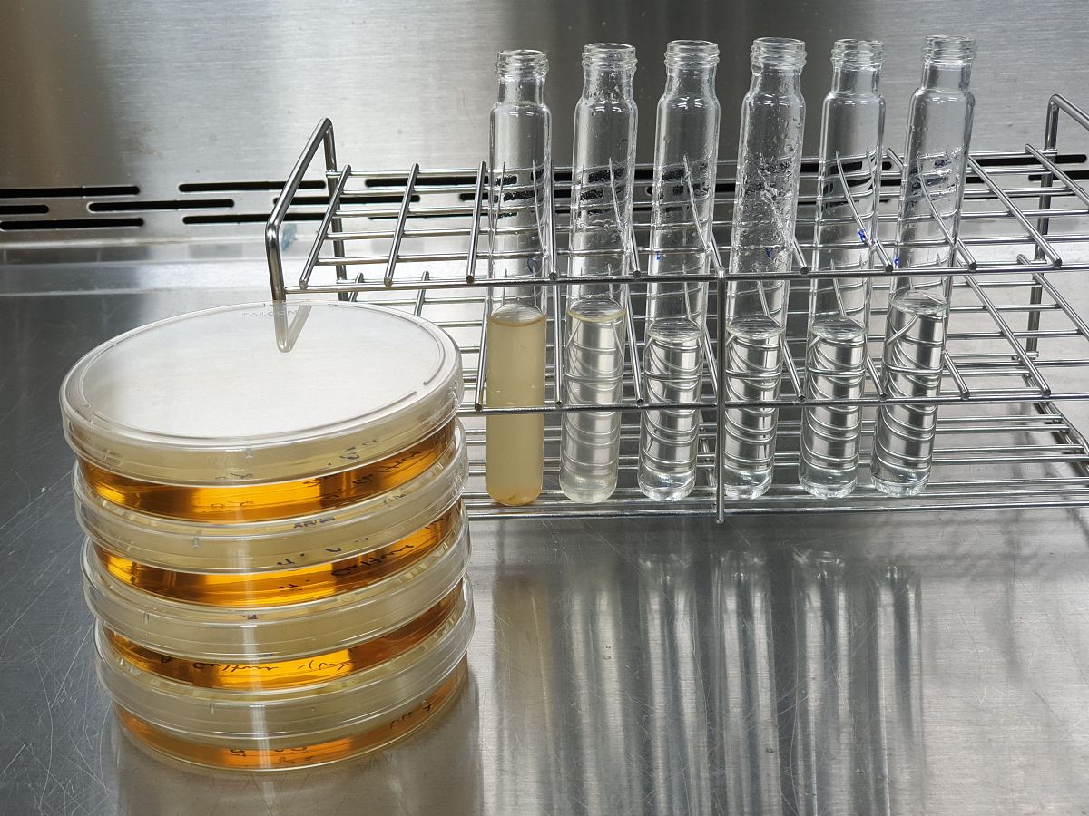 用血球计数板计数时为什么注入的菌液不能过多？