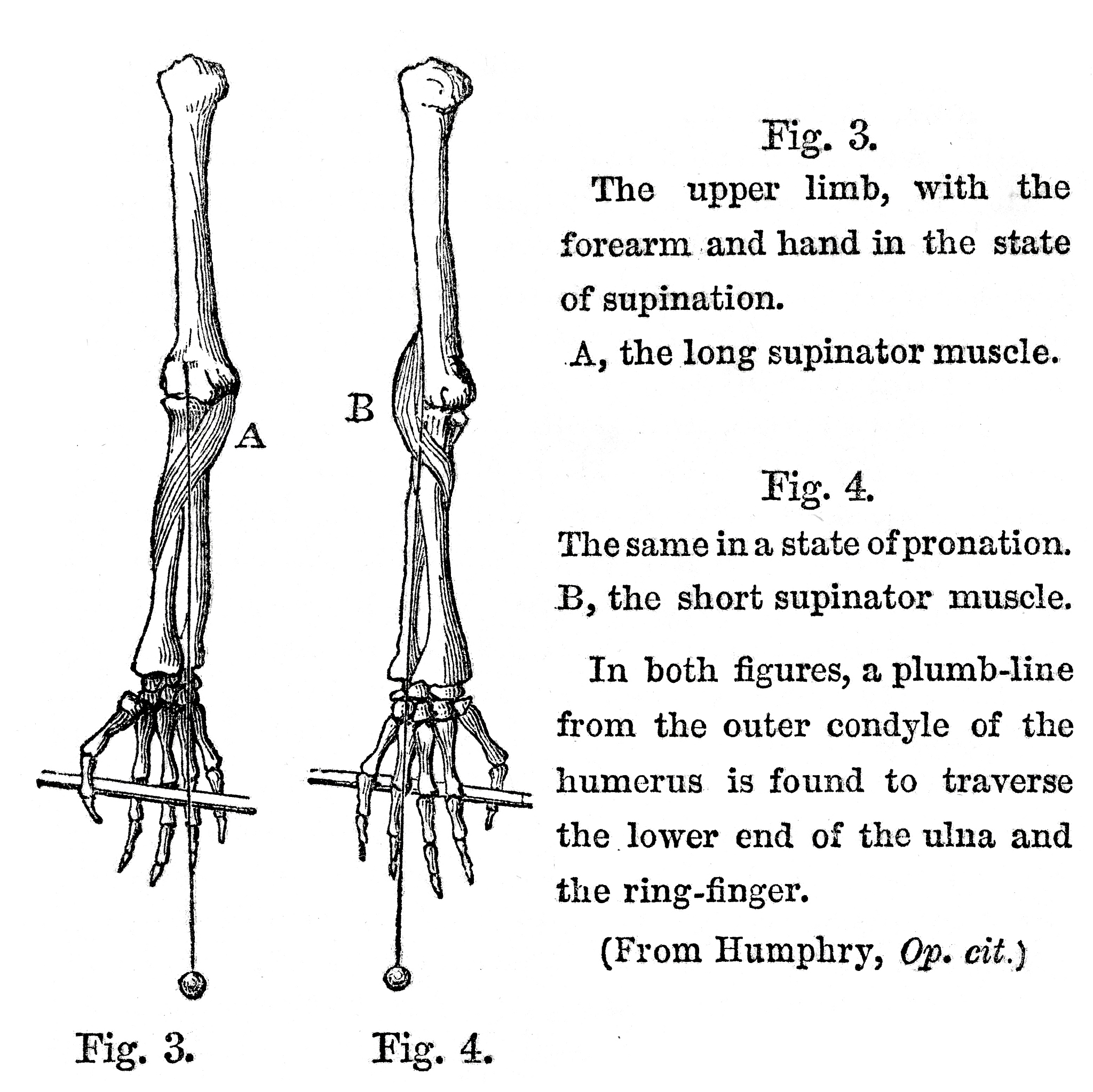 中臂肿块 - 人体骨骼翻译