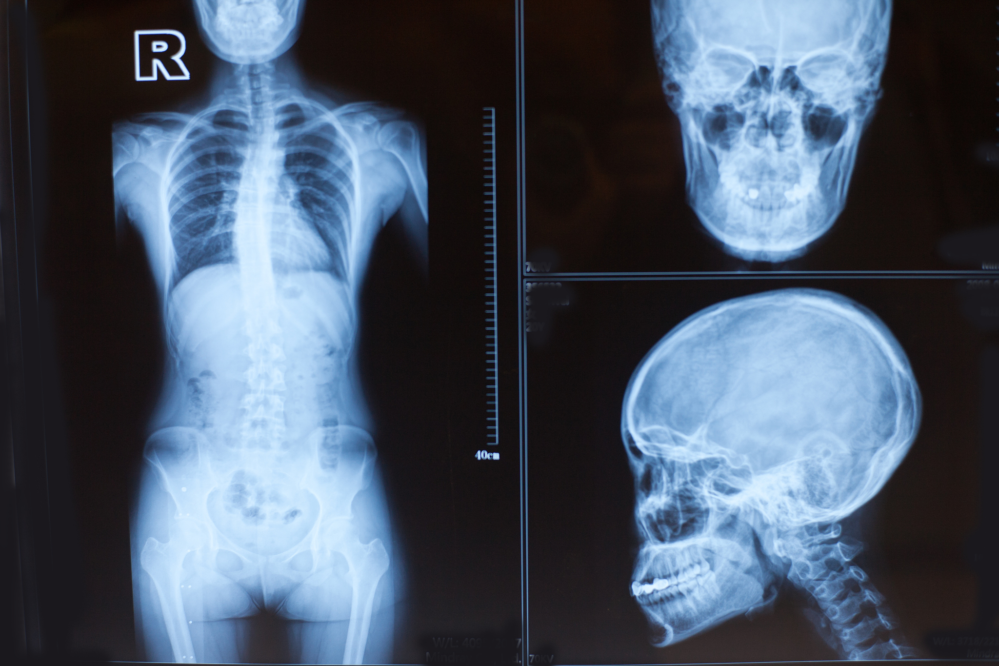 左眼跳财右眼跳灾