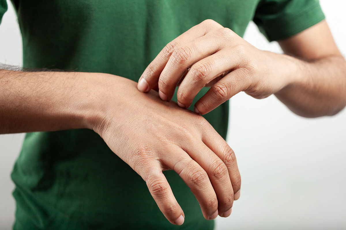 皮肤瘙痒难忍？警惕胆汁淤积性瘙痒！