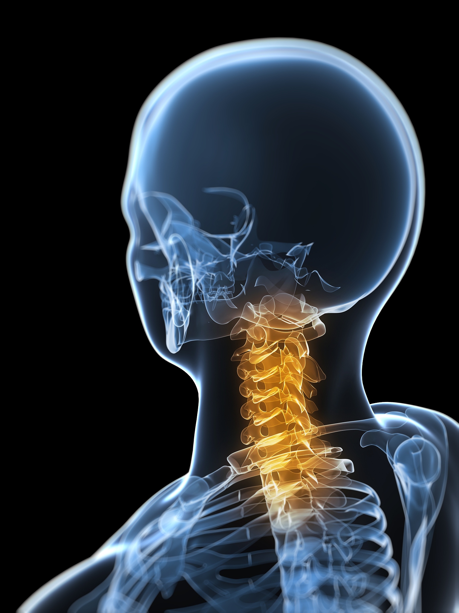 骨髓型颈椎病：症状、治疗与预防