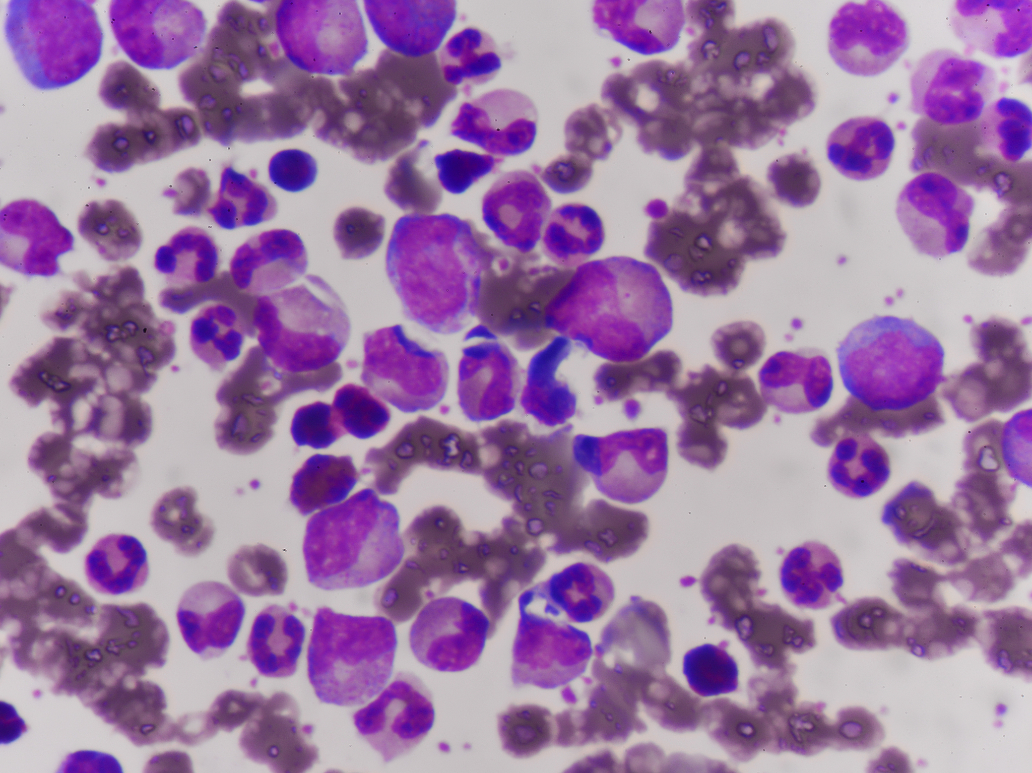 HE染色可以观察肿瘤浸润情况吗？生物医学专家解答