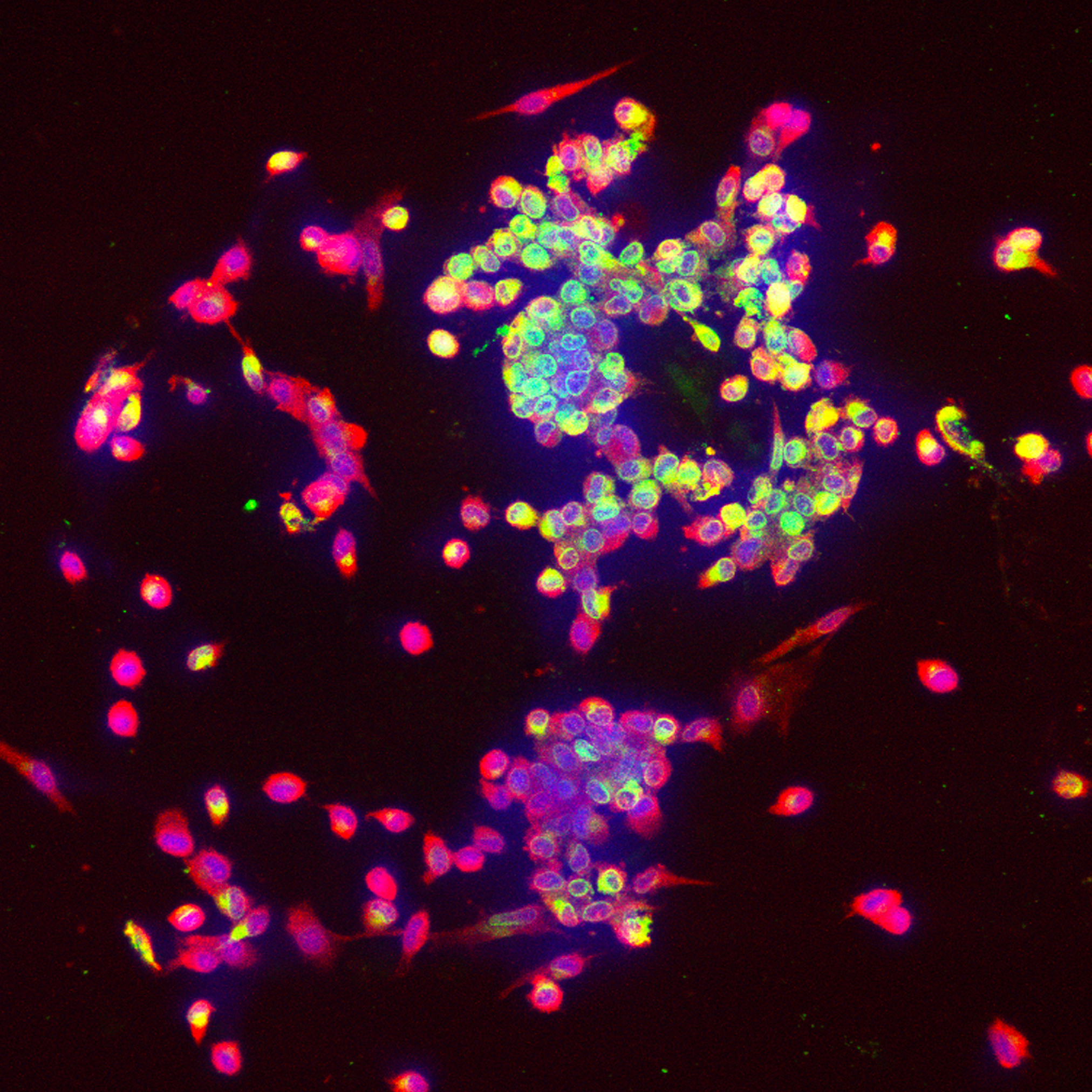 没有乙酰化抗体用免疫荧光的方法怎么检测