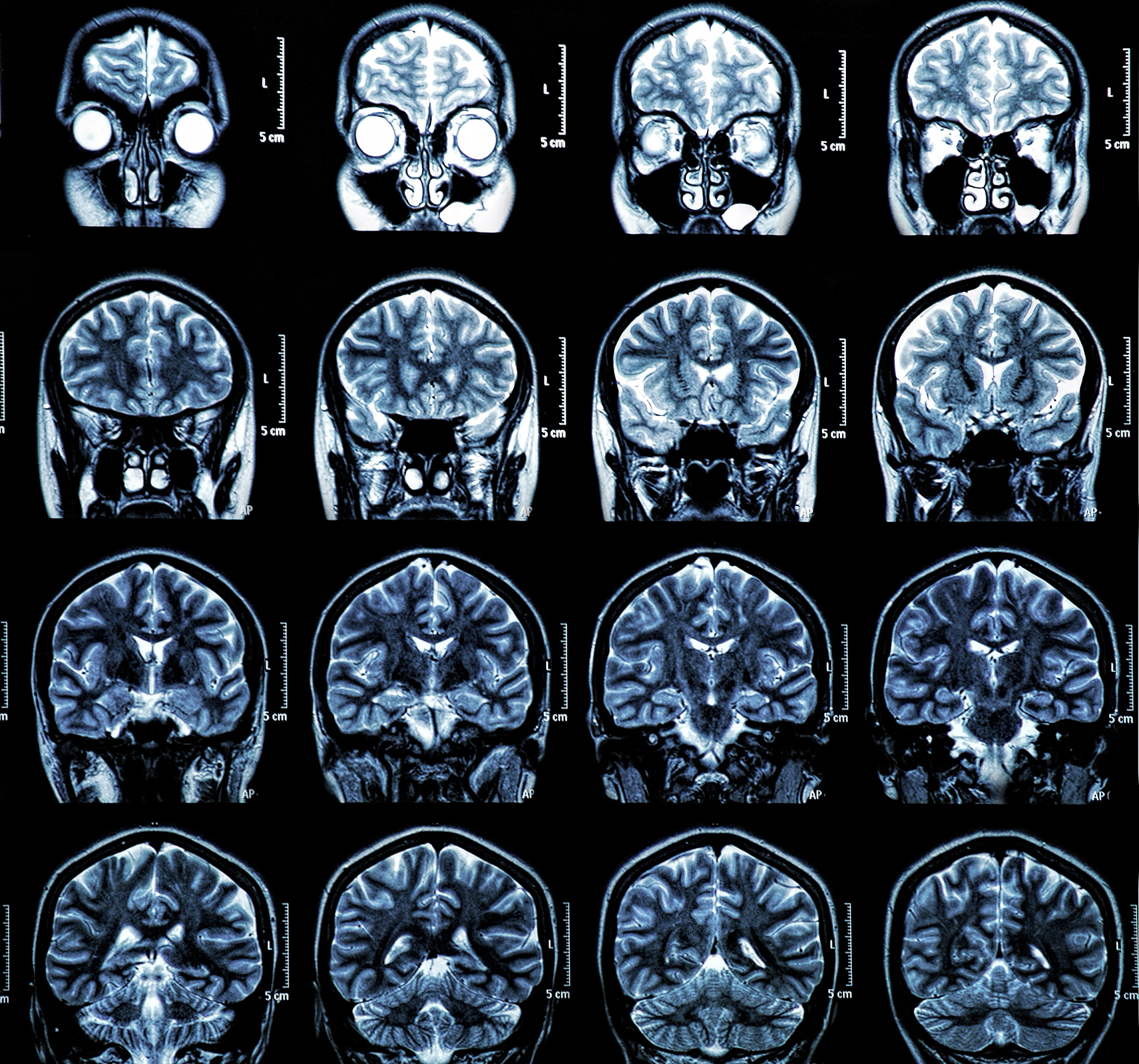 合成磁共振技术在ADHD研究中的应用：现状与未来方向