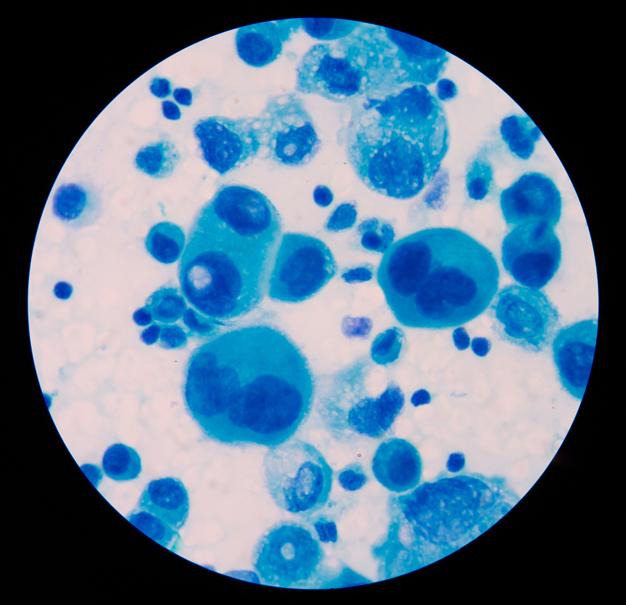 亚甲基蓝染色红细胞颜色 - 深蓝色