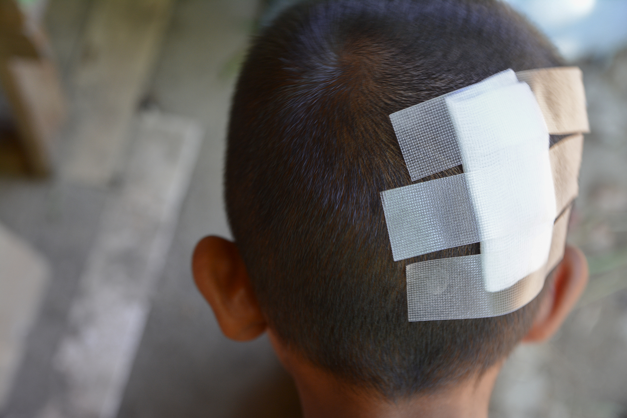 close-up of boy with bandage on head