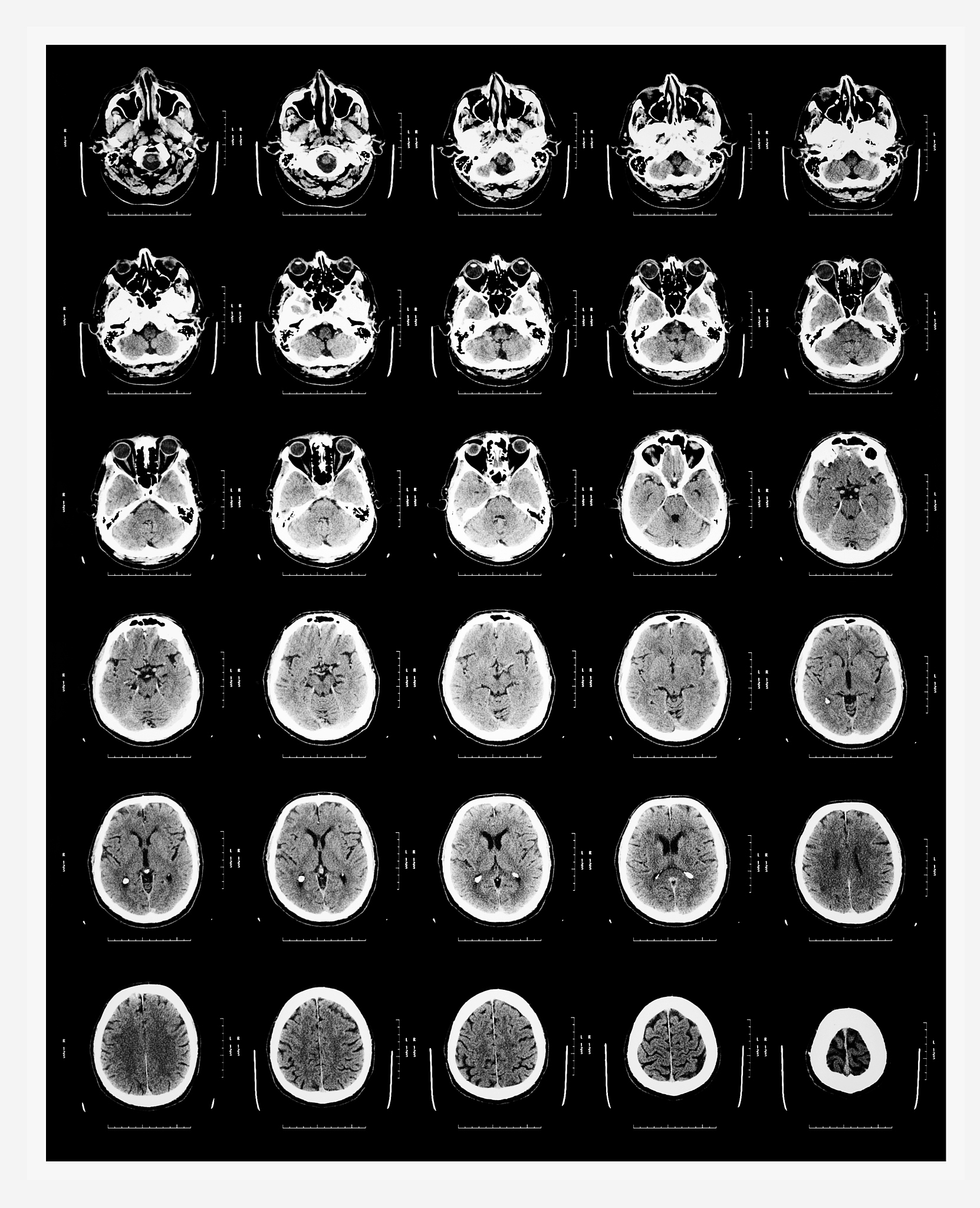 遵义卫生学校医学影像技术专业怎么样？教学质量好不好？
