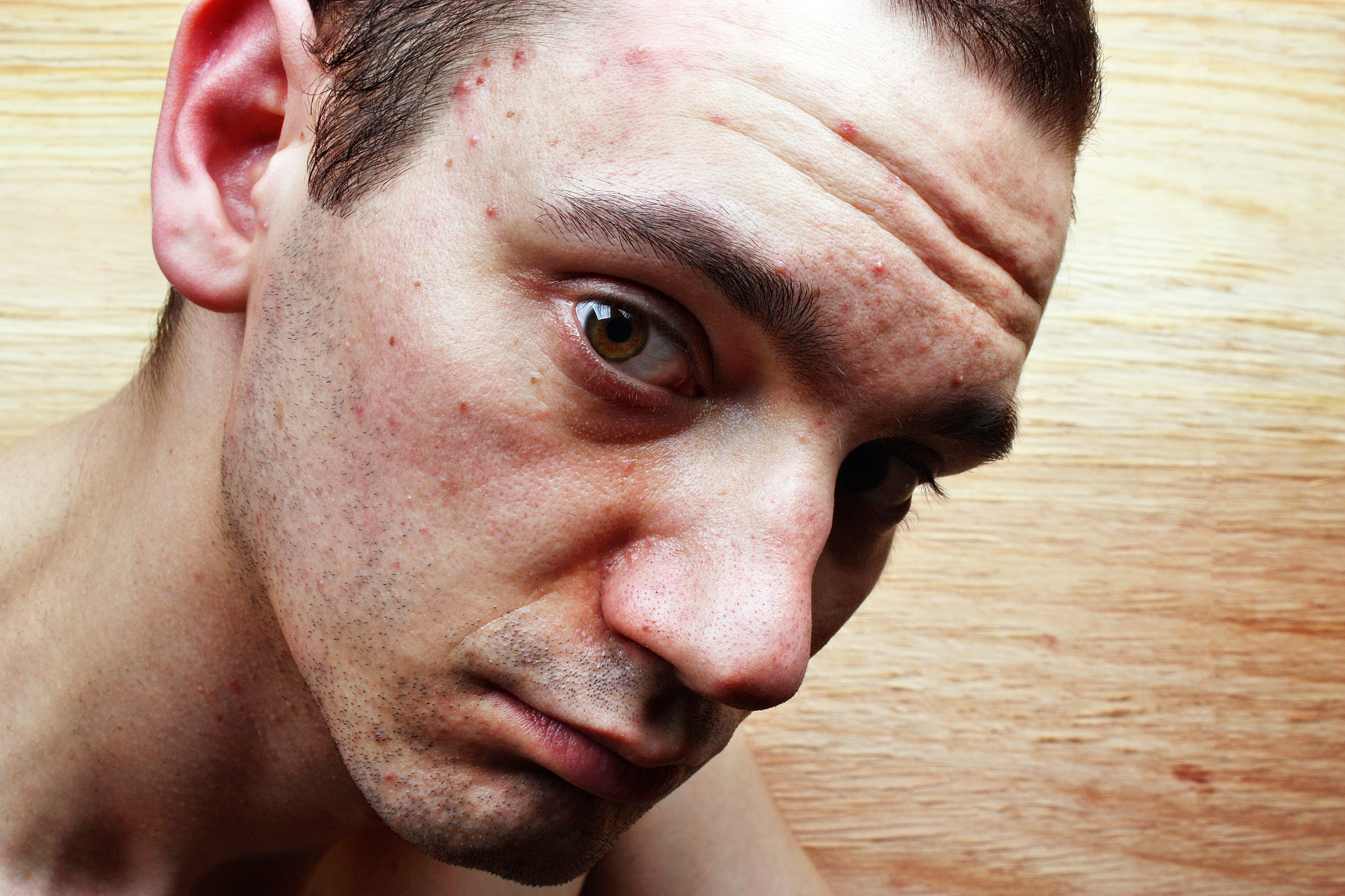 脸部过敏可以通过不洗脸来自愈吗