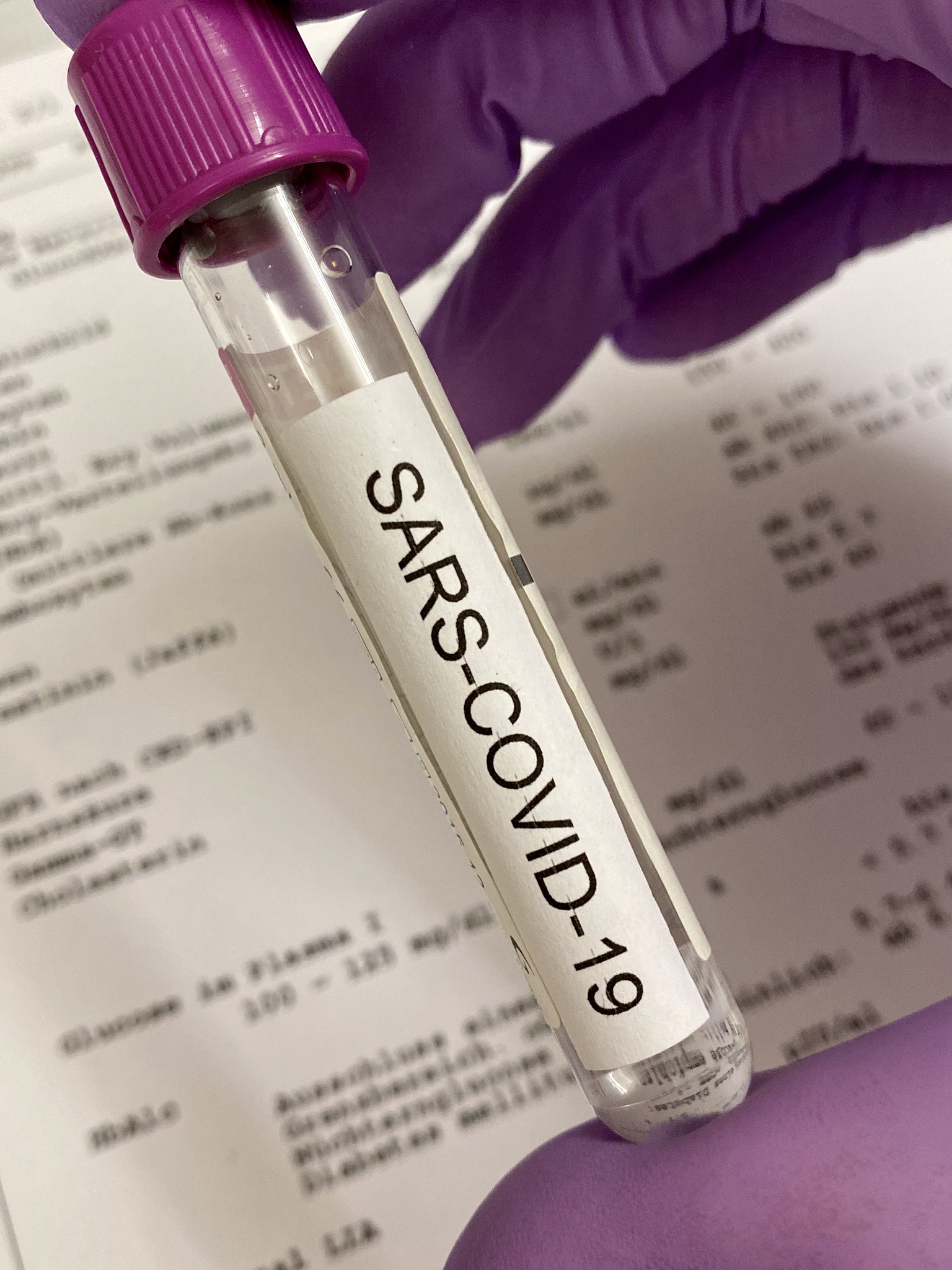 疾控中心实习记录：经验分享和技能提升