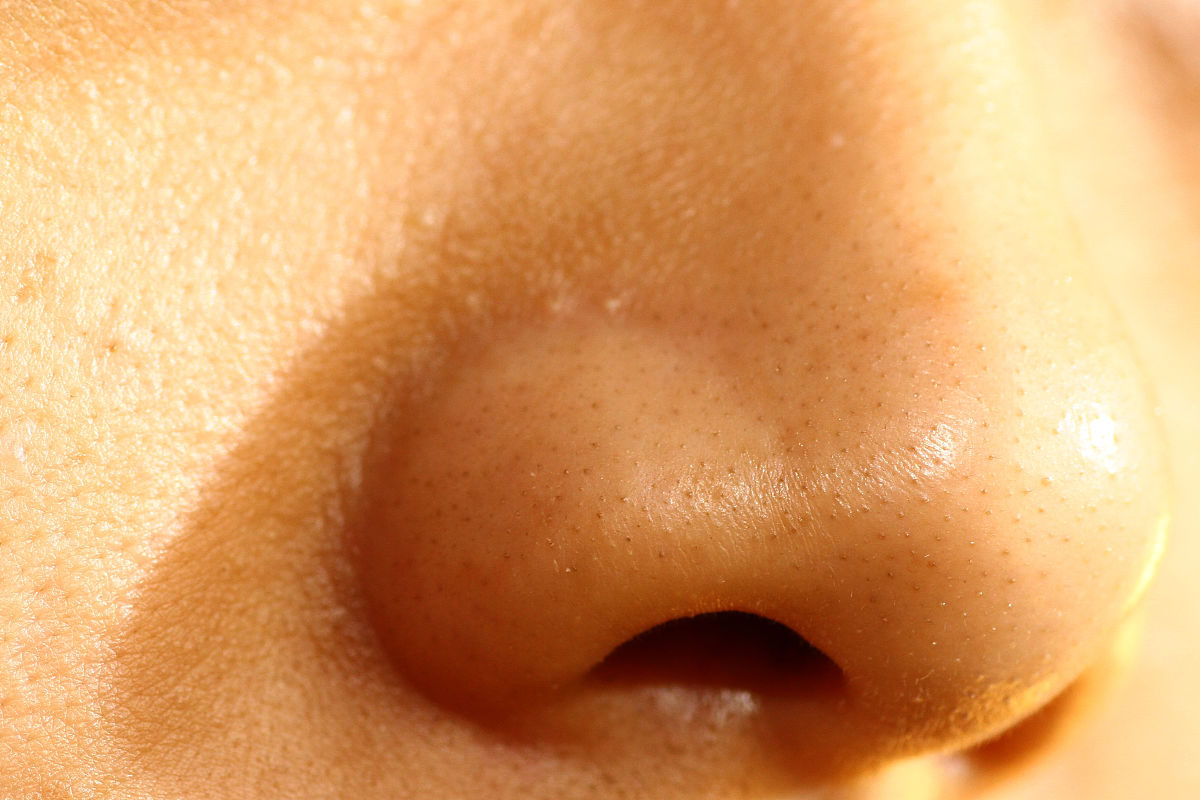 儿童鼻子上长小点