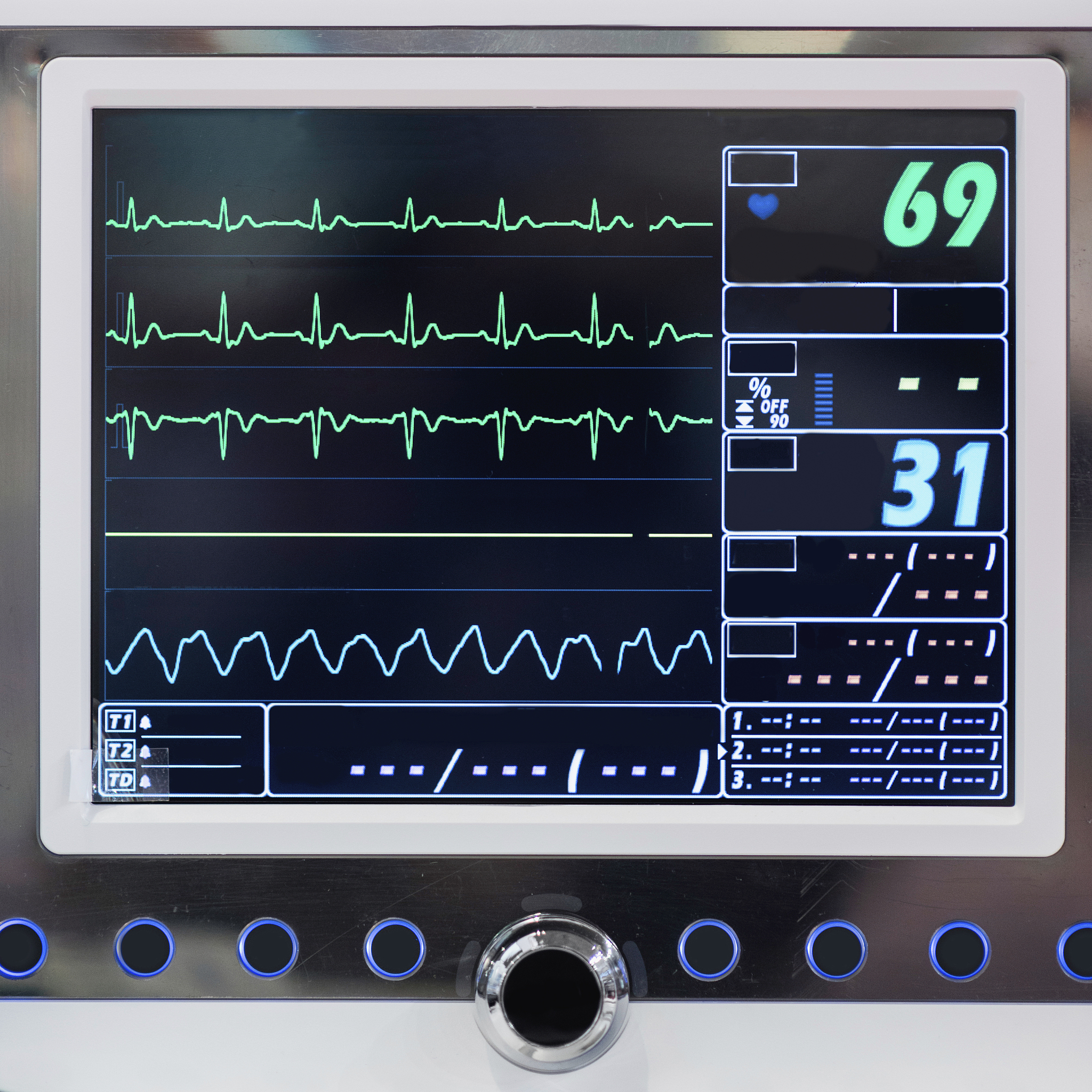 光电容积脉搏波描记法(PPG)原理及应用