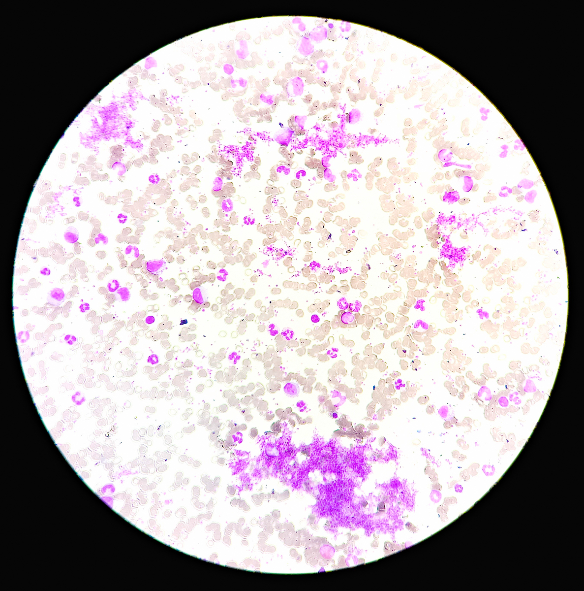 亚甲基蓝染色后的红细胞颜色